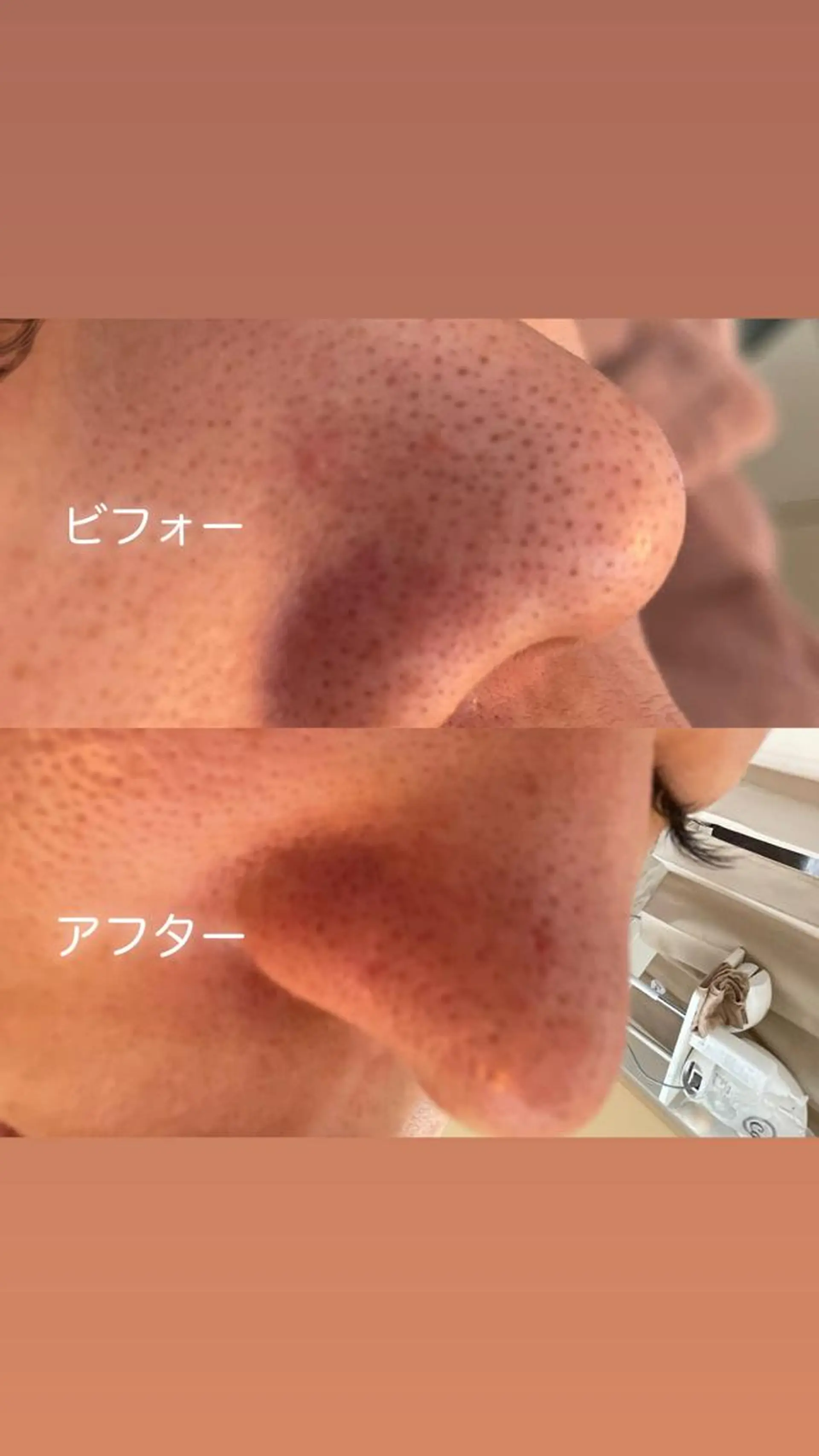 VERY VERY九条店所属・VERYVERY🌹 ビューティーサロンのエステ・リラクイメージ