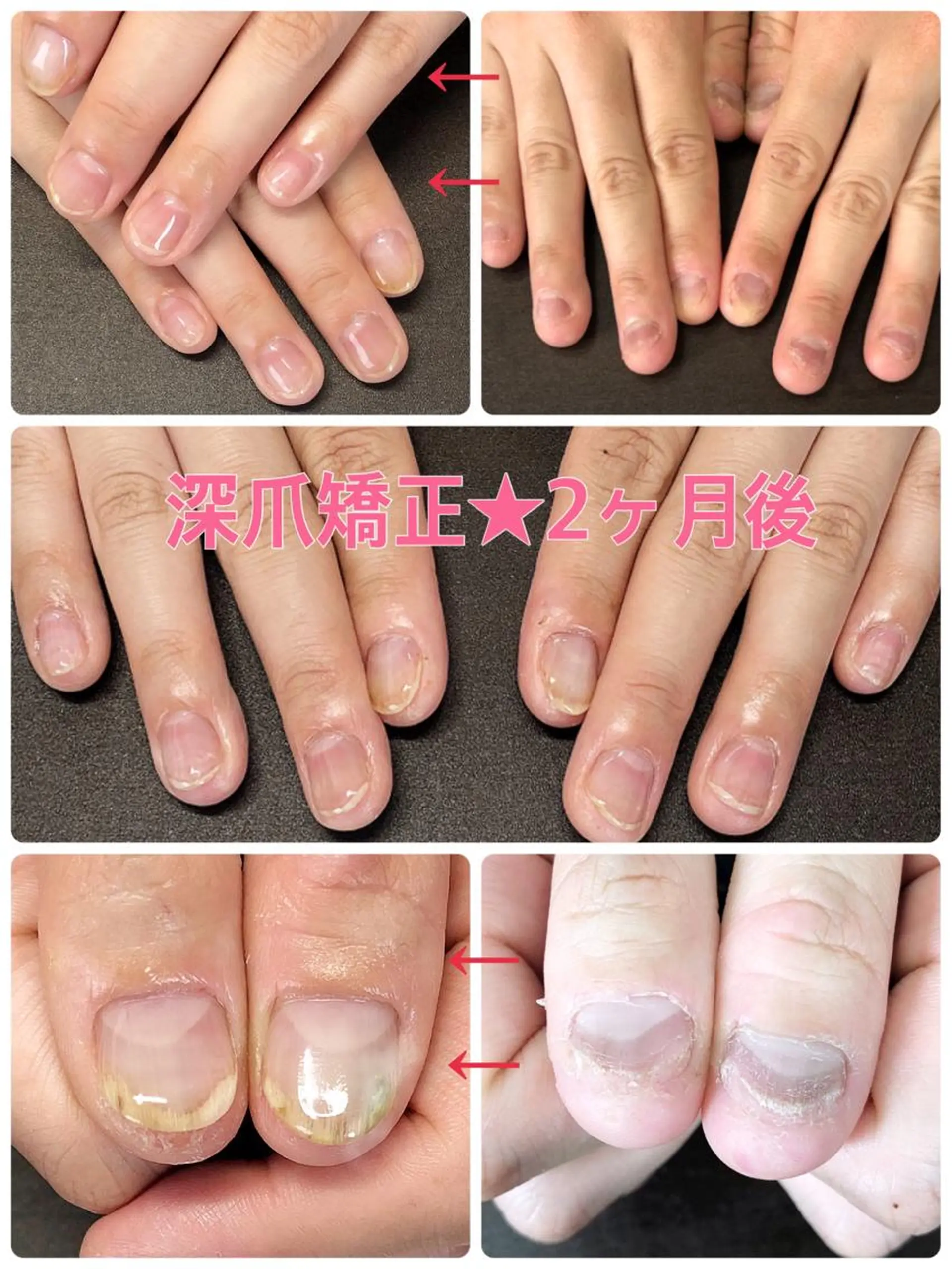 ネイル Nojima mのネイルデザイン