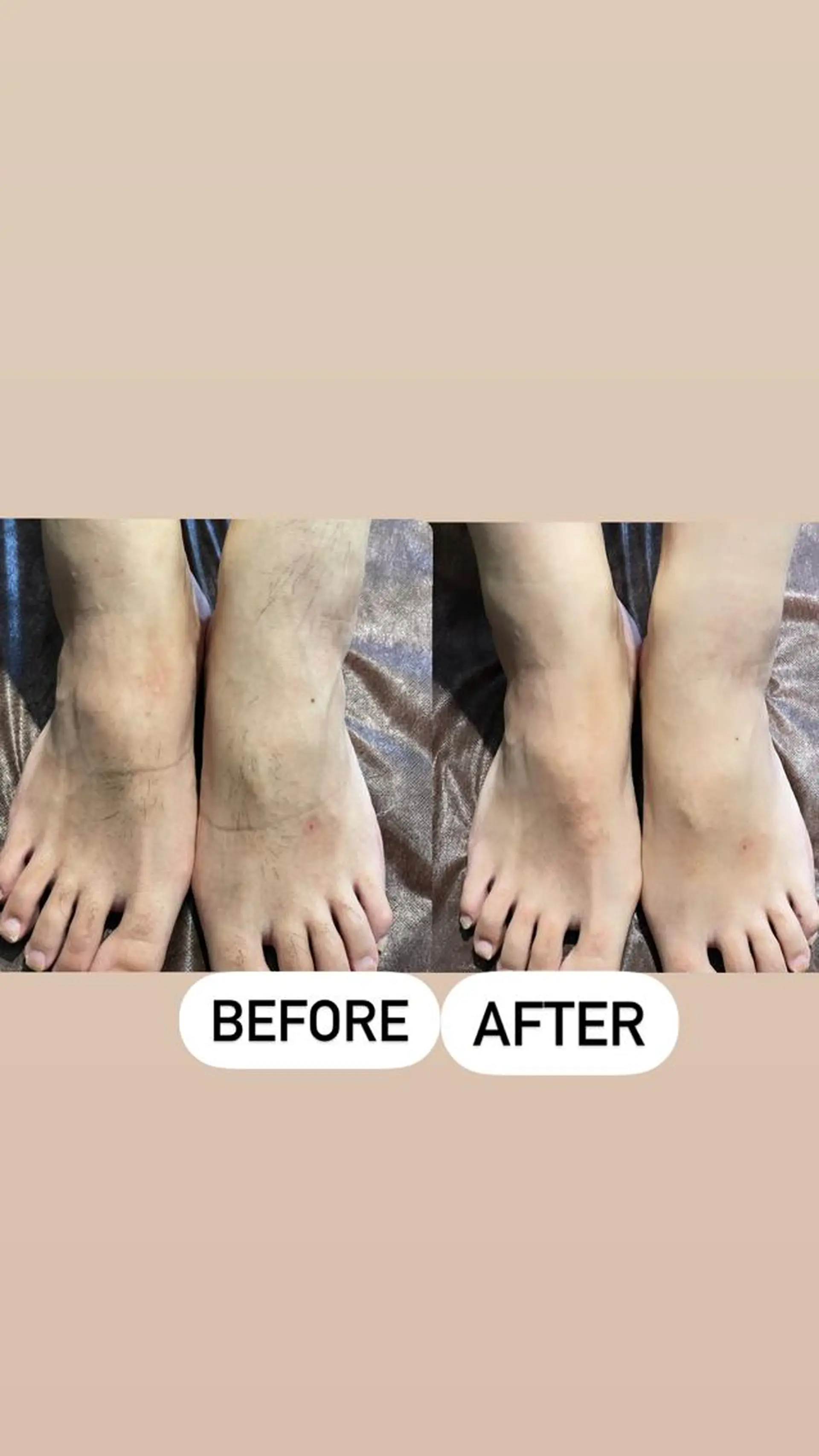 メンズ 脱毛 メンズ眉毛ITSUK Iメンズ専門　新宿の眉毛・アイブロウイメージ