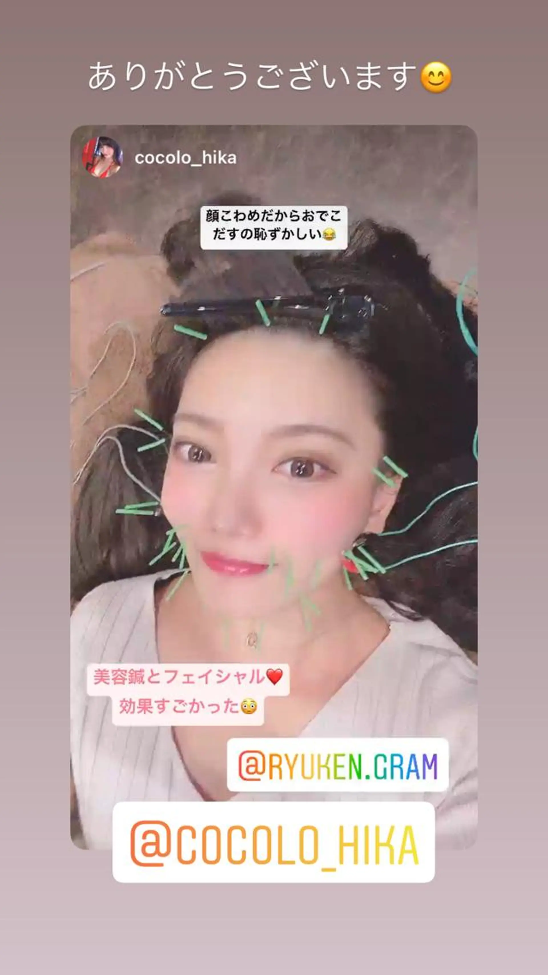 エステ リラク 美容鍼灸サロン LOMIHARIのエステ・リラクイメージ