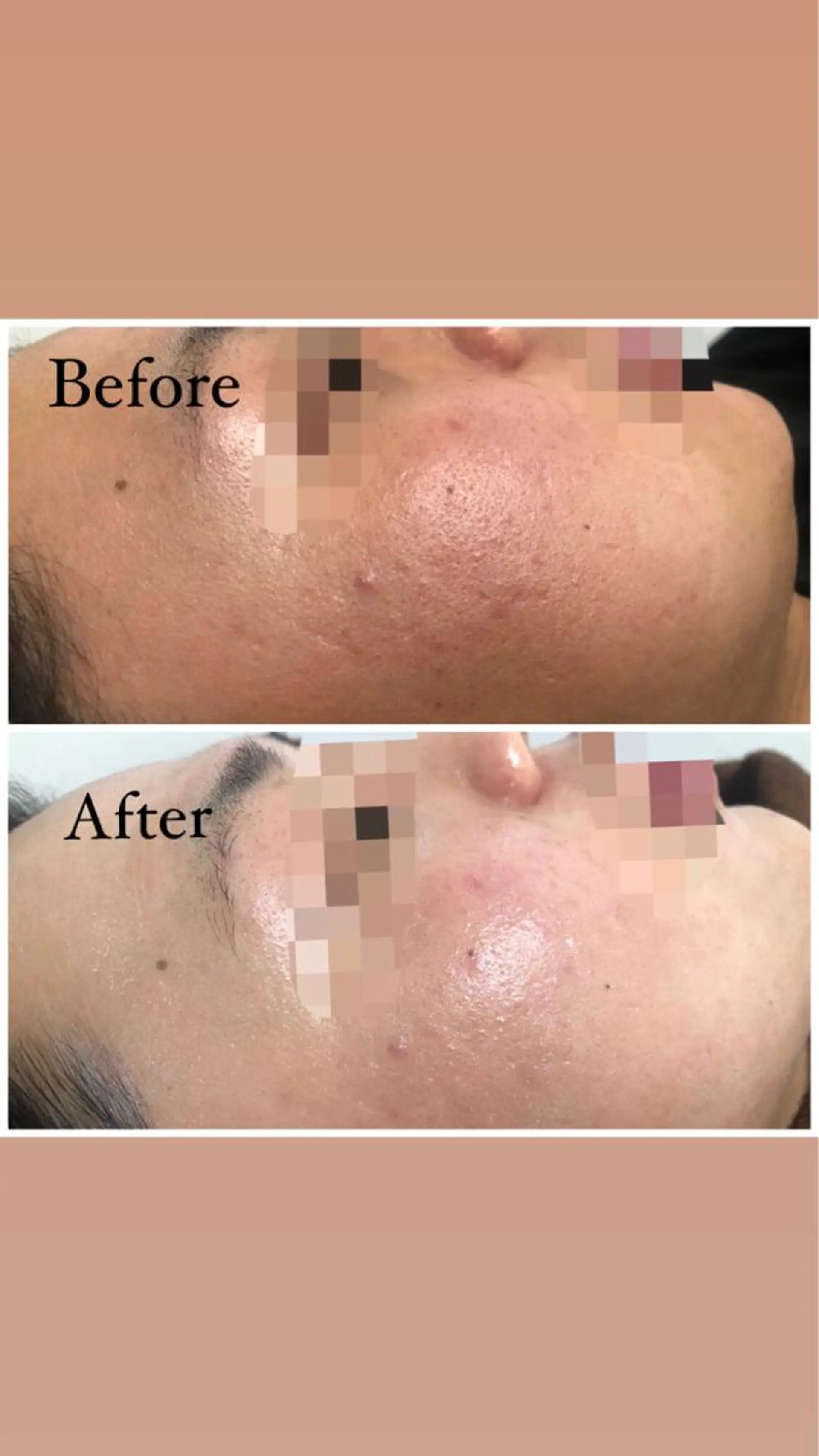 ロング カラー パーマ ヘアアレンジ メンズ キッズ ネイル マツエク・マツパ Amaryllis 🌹のエステ・リラクイメージ