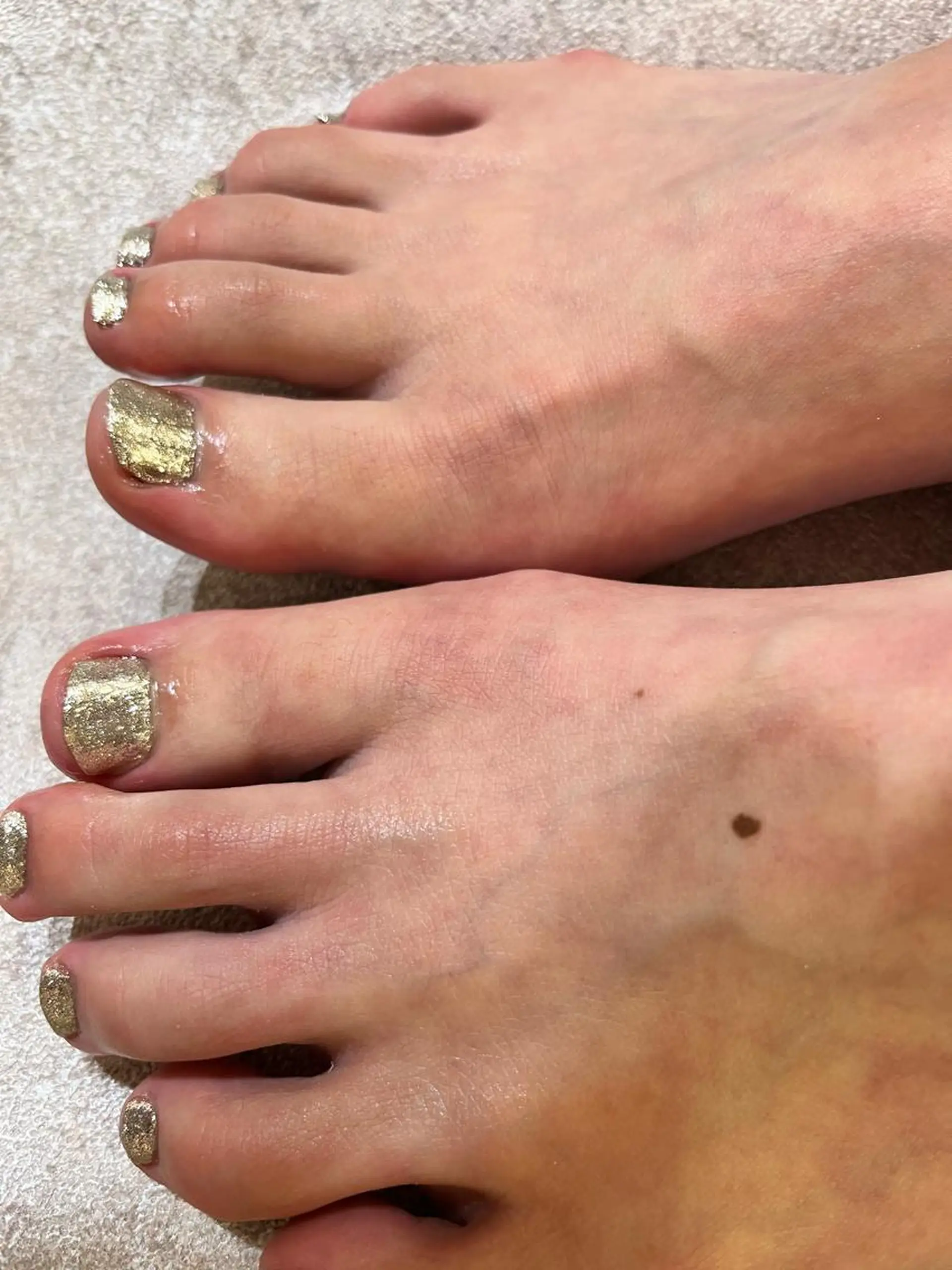 ネイル フットネイル キラキラネイル シルバー ネイルサロンエーナイン平岸店所属・齋藤 英理のネイルデザイン