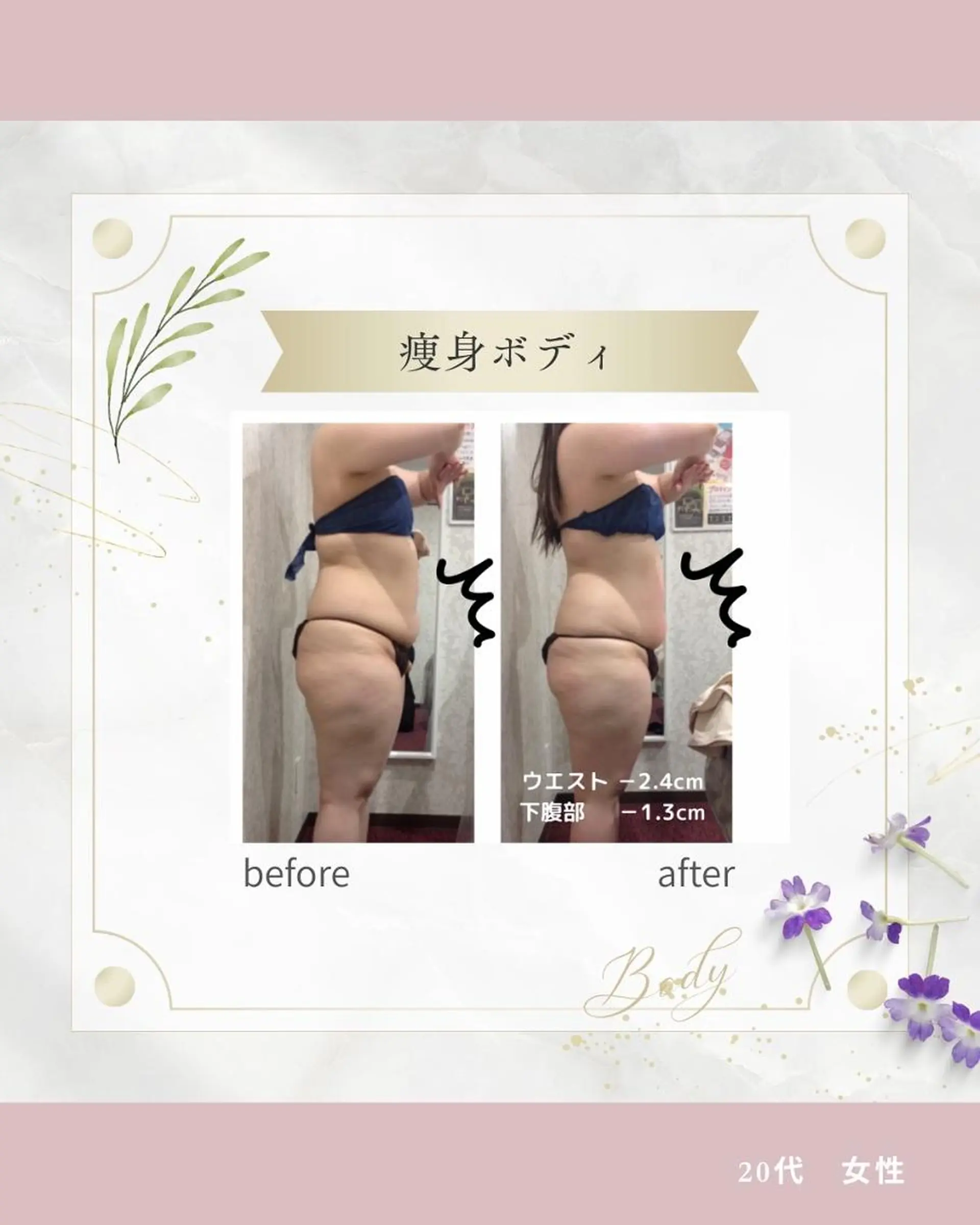 痩身専門エステ addissimoのエステ・リラクイメージ