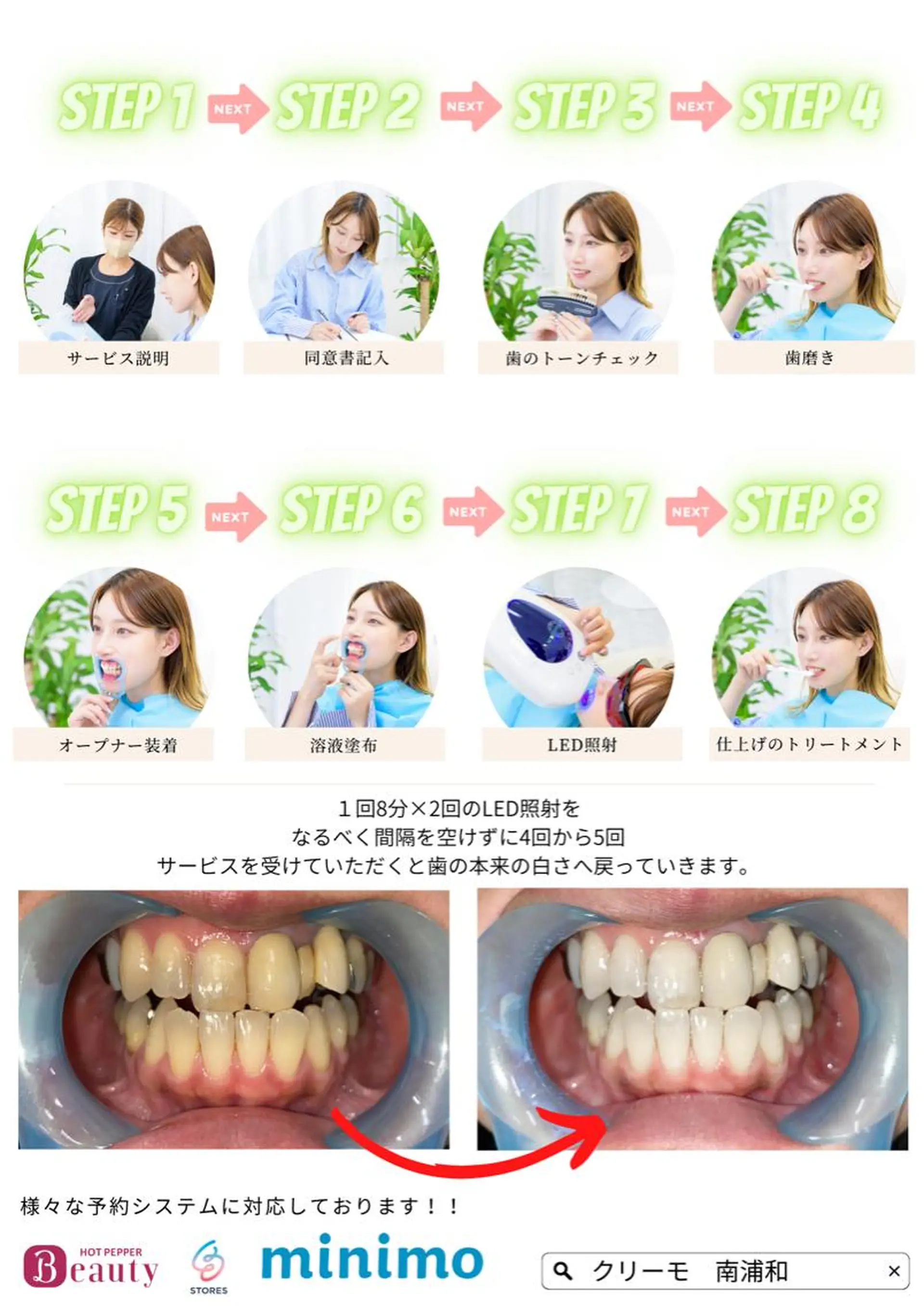 その他 歯のホワイトニング CREEMO南浦和のその他イメージ