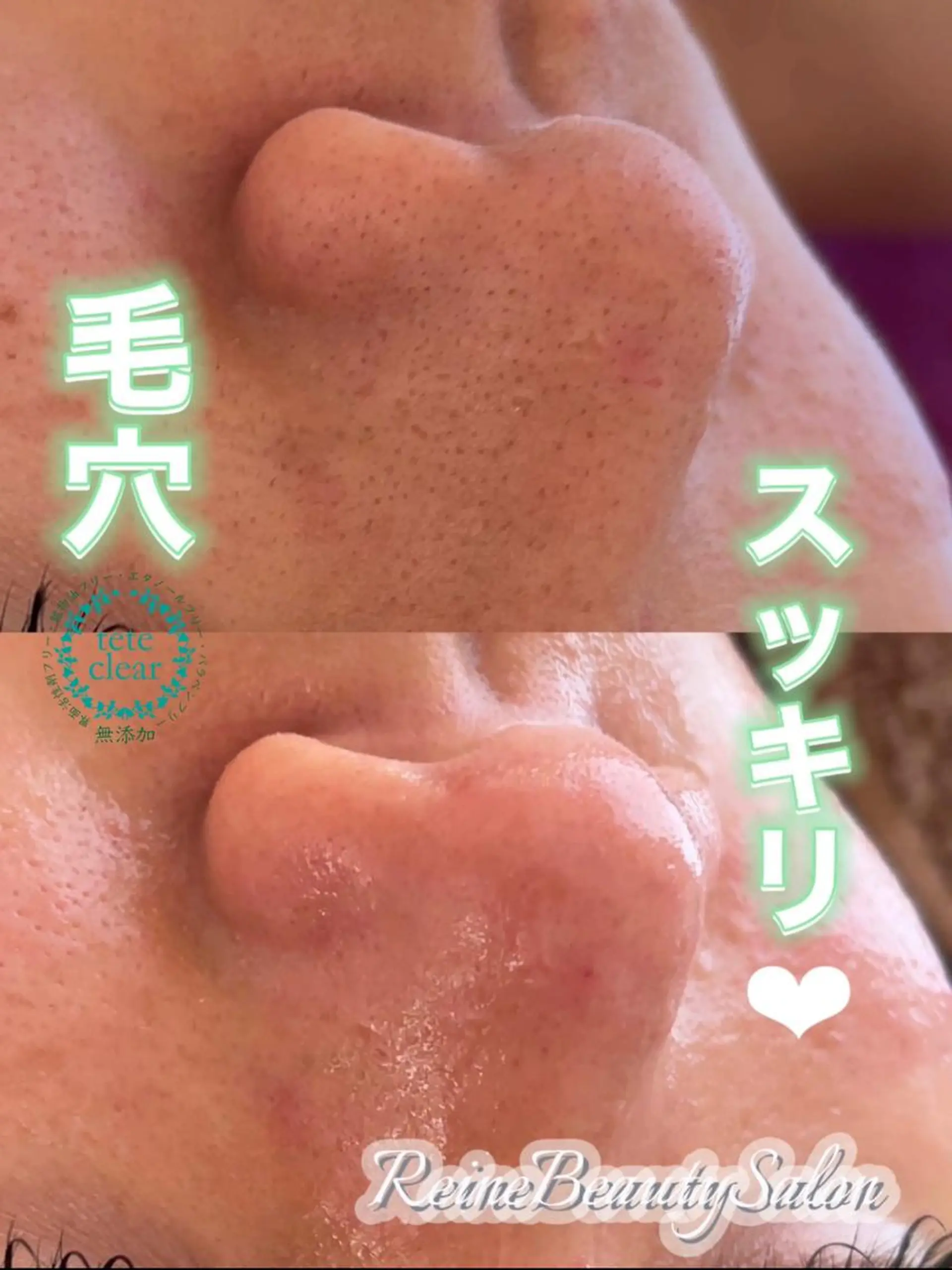 エステ Reine BeautySalon所属・毛穴/シミ肝斑/脱毛 横山梨里のエステ・リラクイメージ