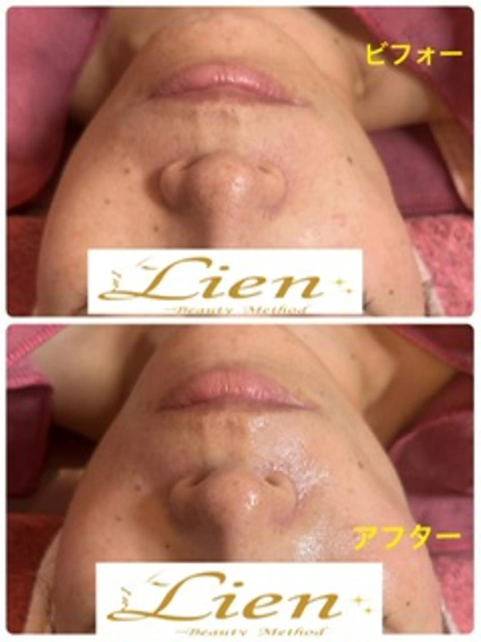 Lien オーナー　山口智嘉のエステ・リラクイメージ