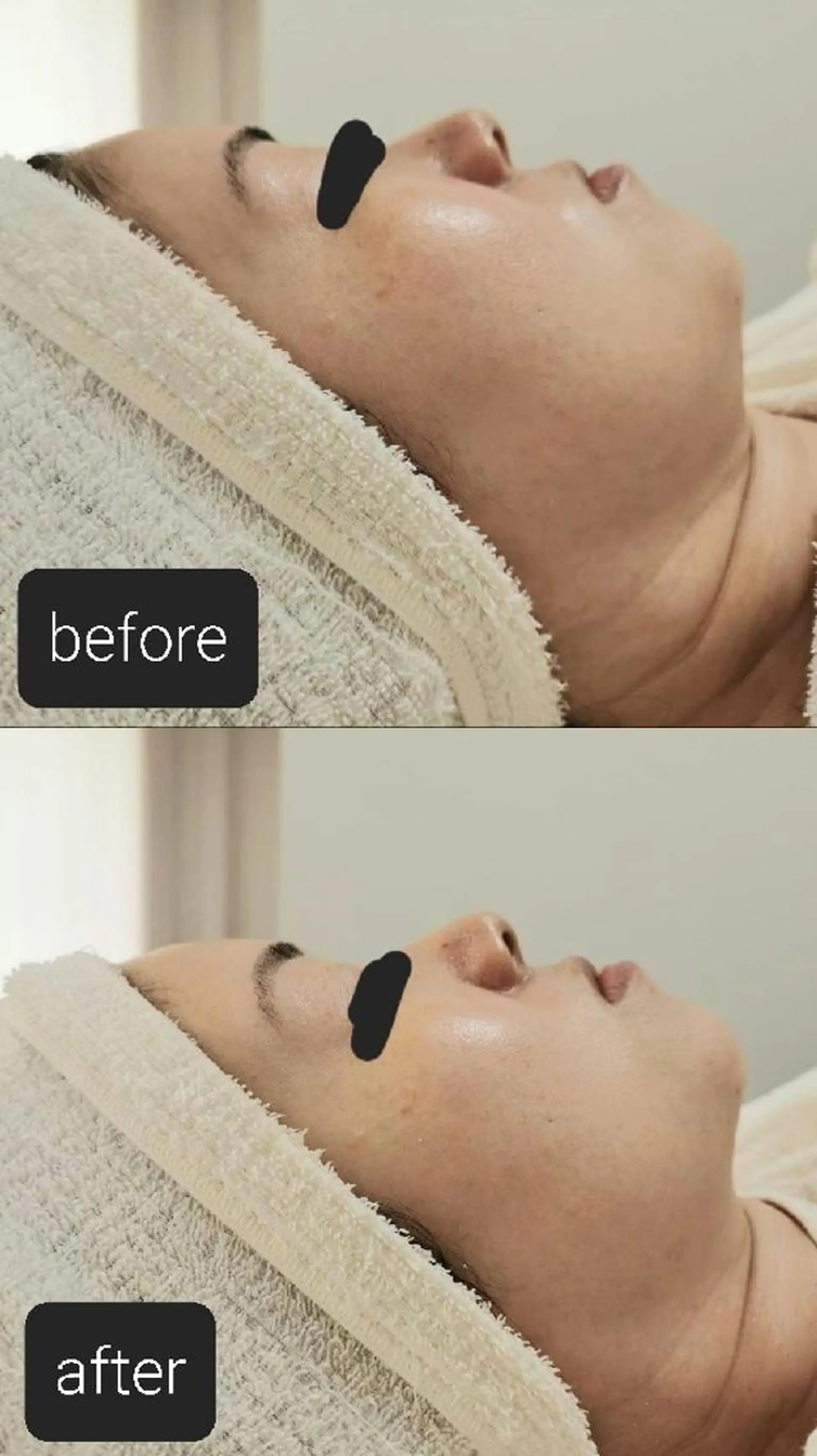 ニキビケア&ニキビ跡 レゾン京橋店 のエステ・リラクイメージ