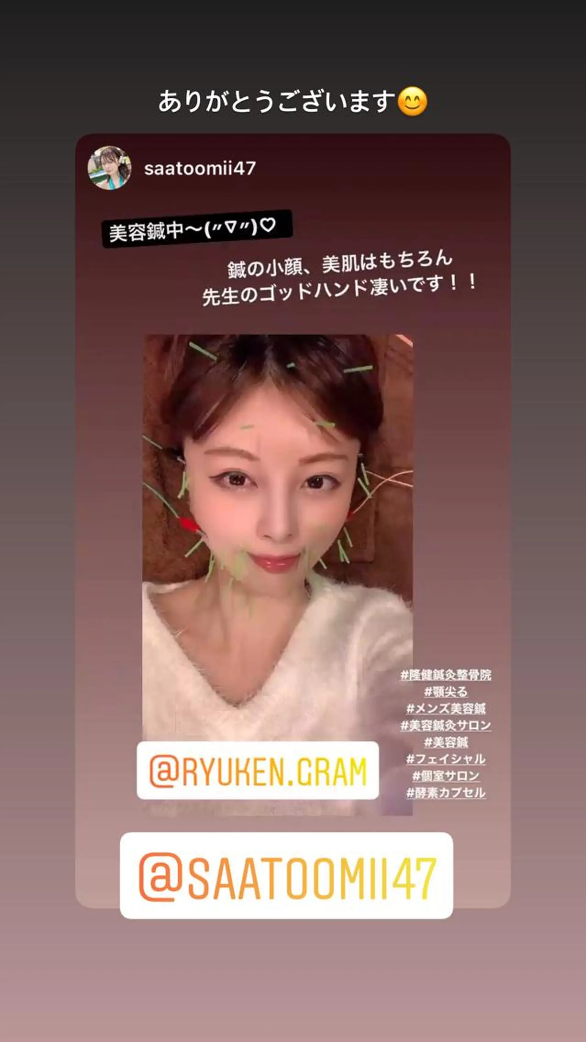 エステ リラク 美容鍼灸サロン LOMIHARIのエステ・リラクイメージ