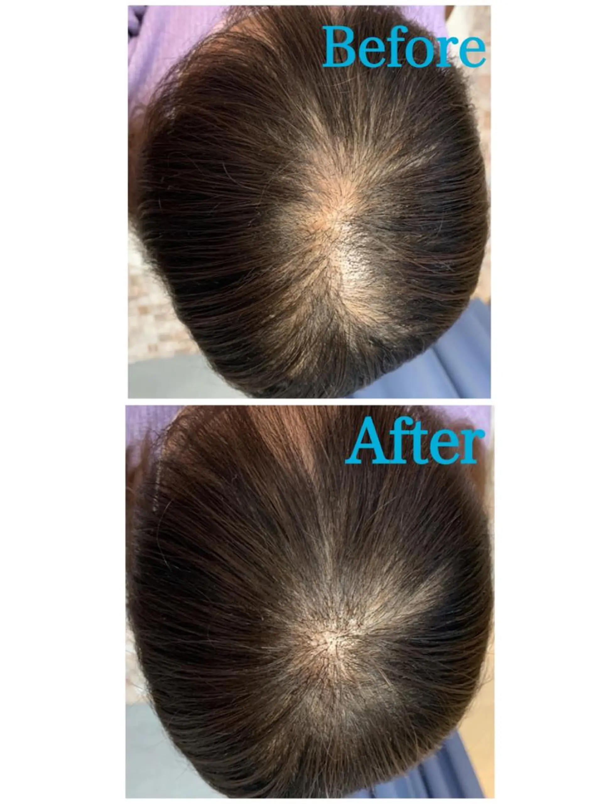 ヘアアレンジ Kanal Kanaのエステ・リラクイメージ