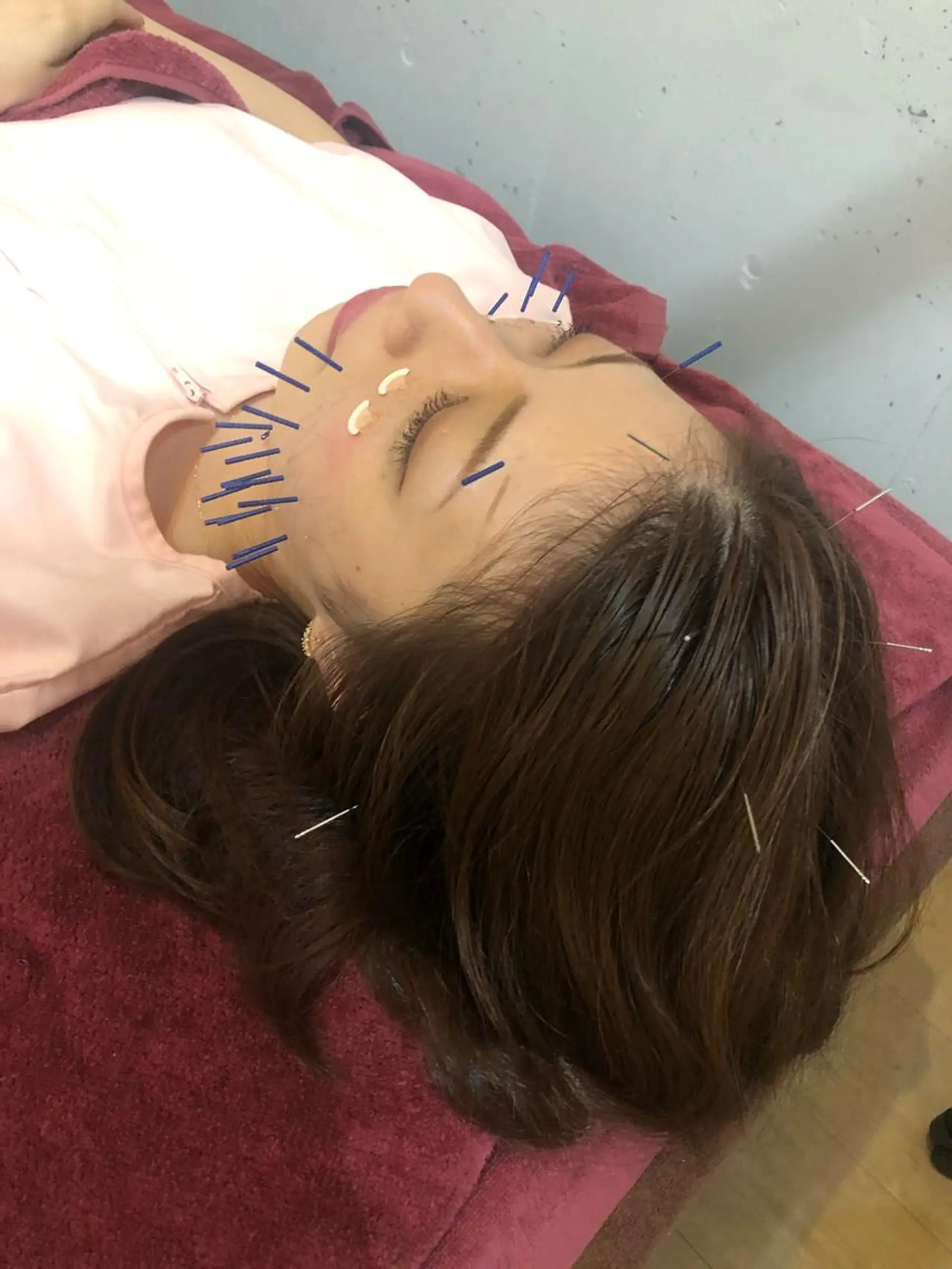 エステ リラク 美容鍼灸女性専用 りんご鍼灸治療院のその他イメージ