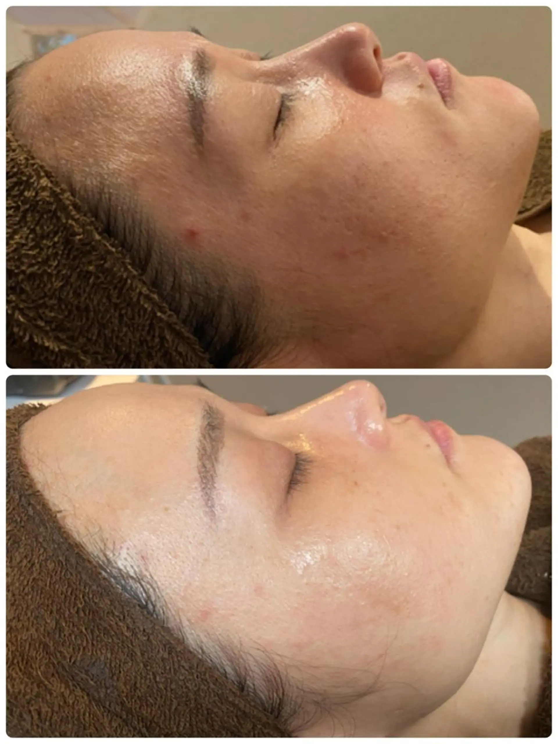 エステ cocorire インターパークの眉毛・アイブロウイメージ