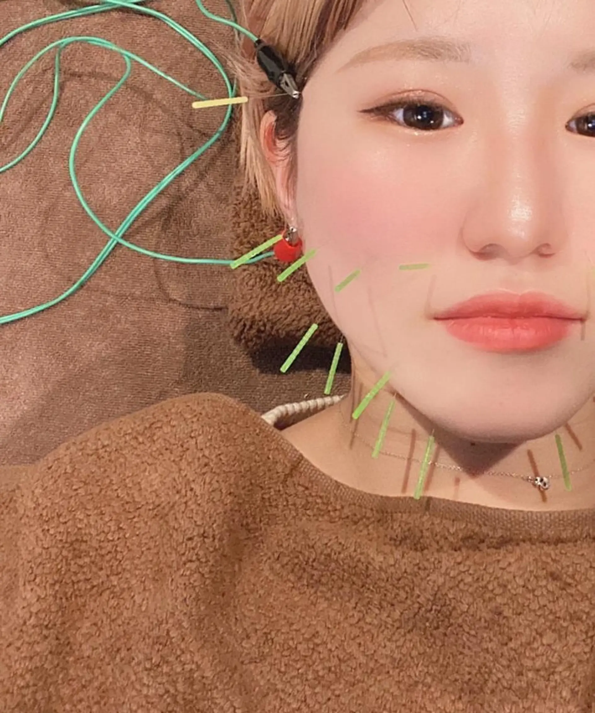 メンズ エステ リラク 美容鍼灸サロン LOMIHARIのエステ・リラクイメージ