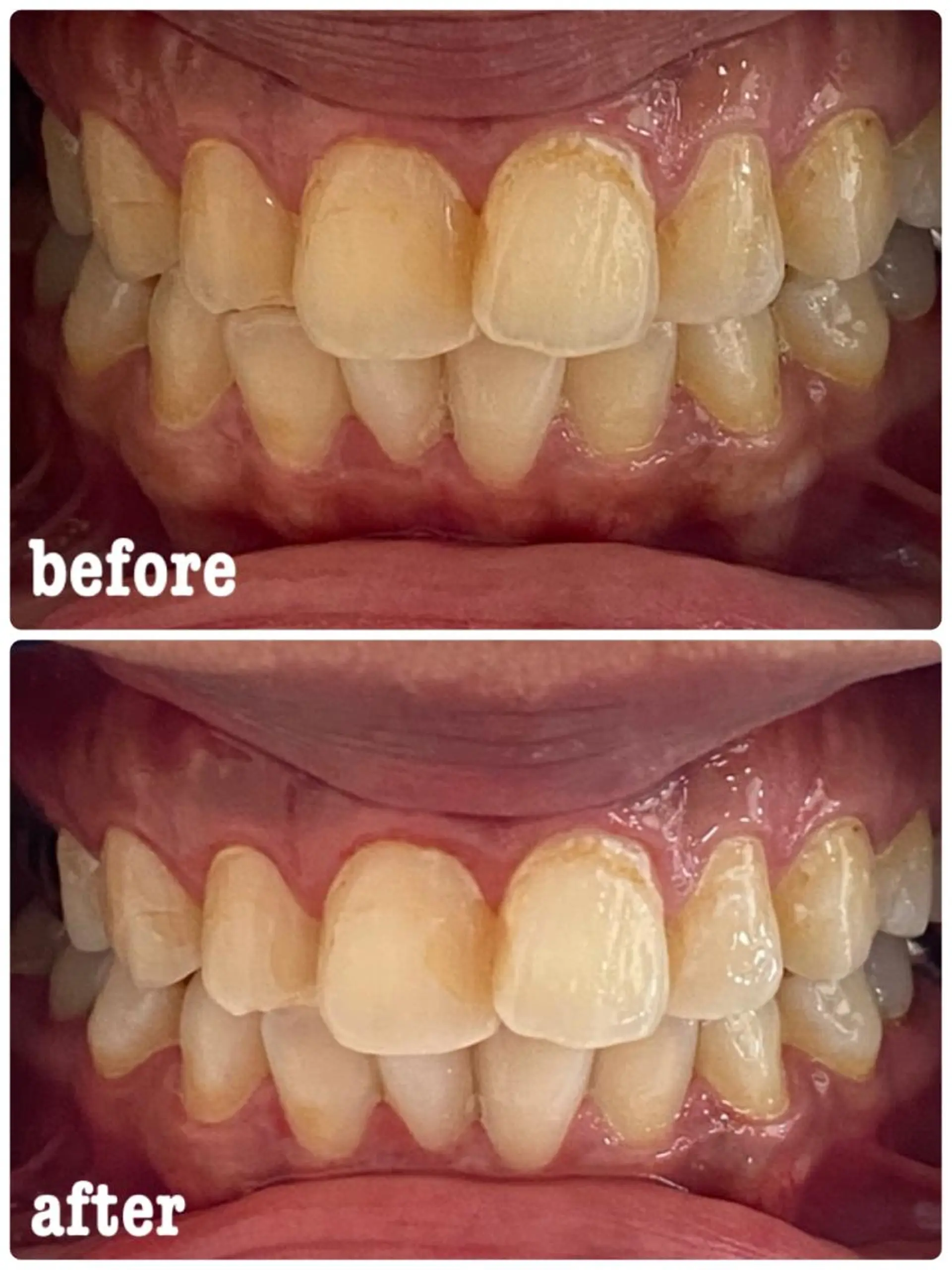 ホワイトニングサロン ラウレアのその他イメージ