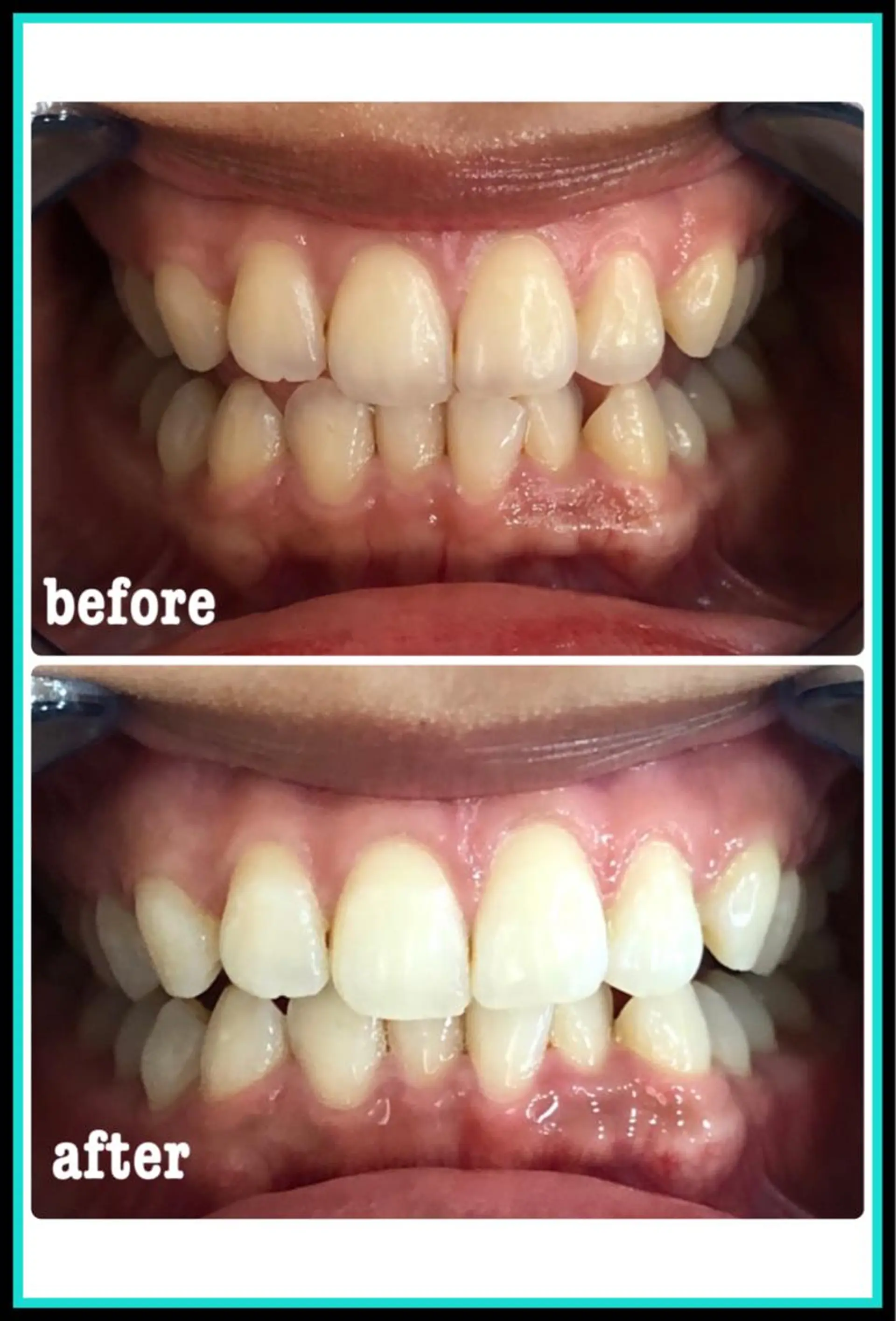 ホワイトニングサロン ラウレアのその他イメージ