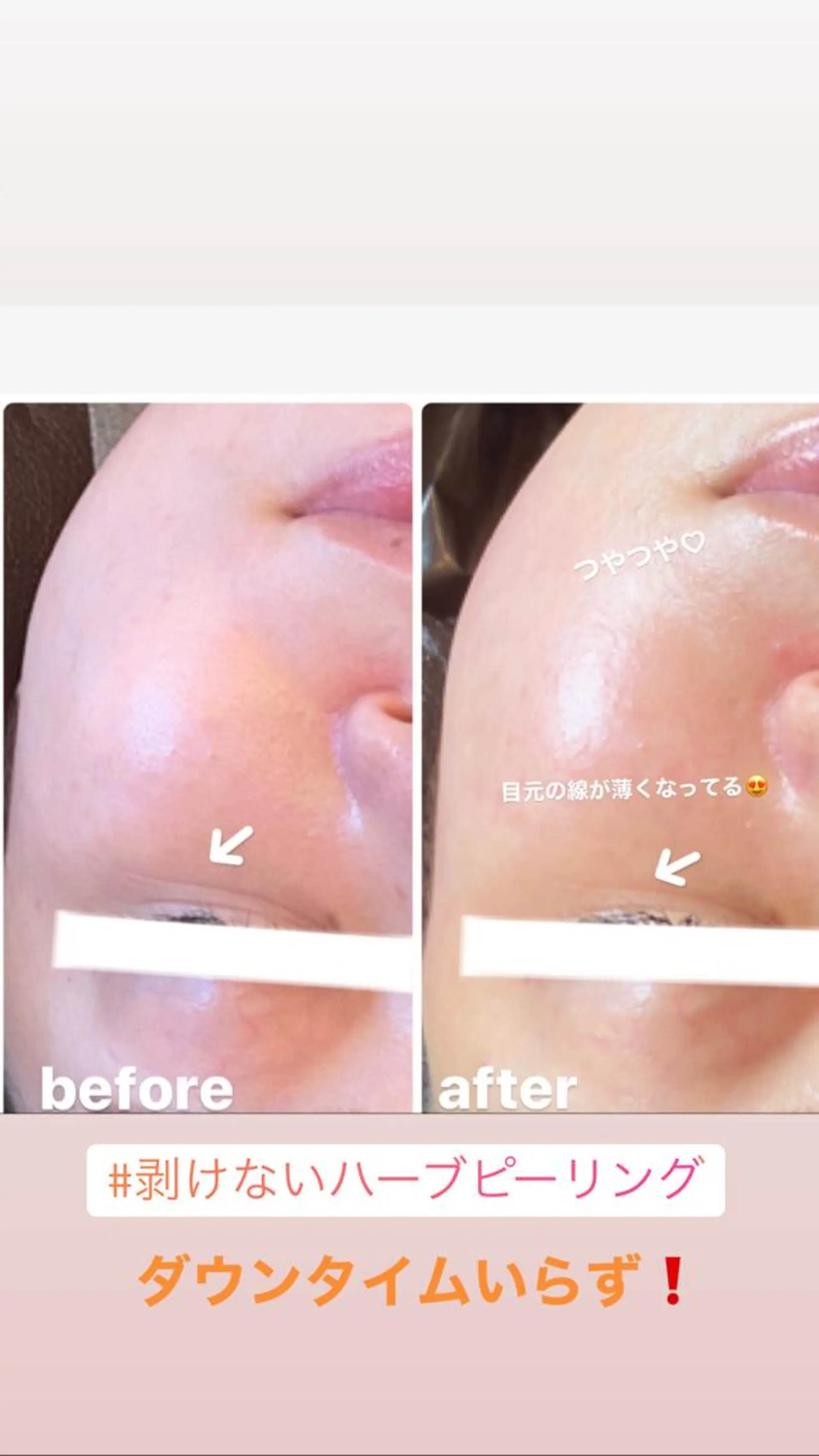 FLEUR大阪・整体 ・ハイフ・痩身・小顔のエステ・リラクイメージ