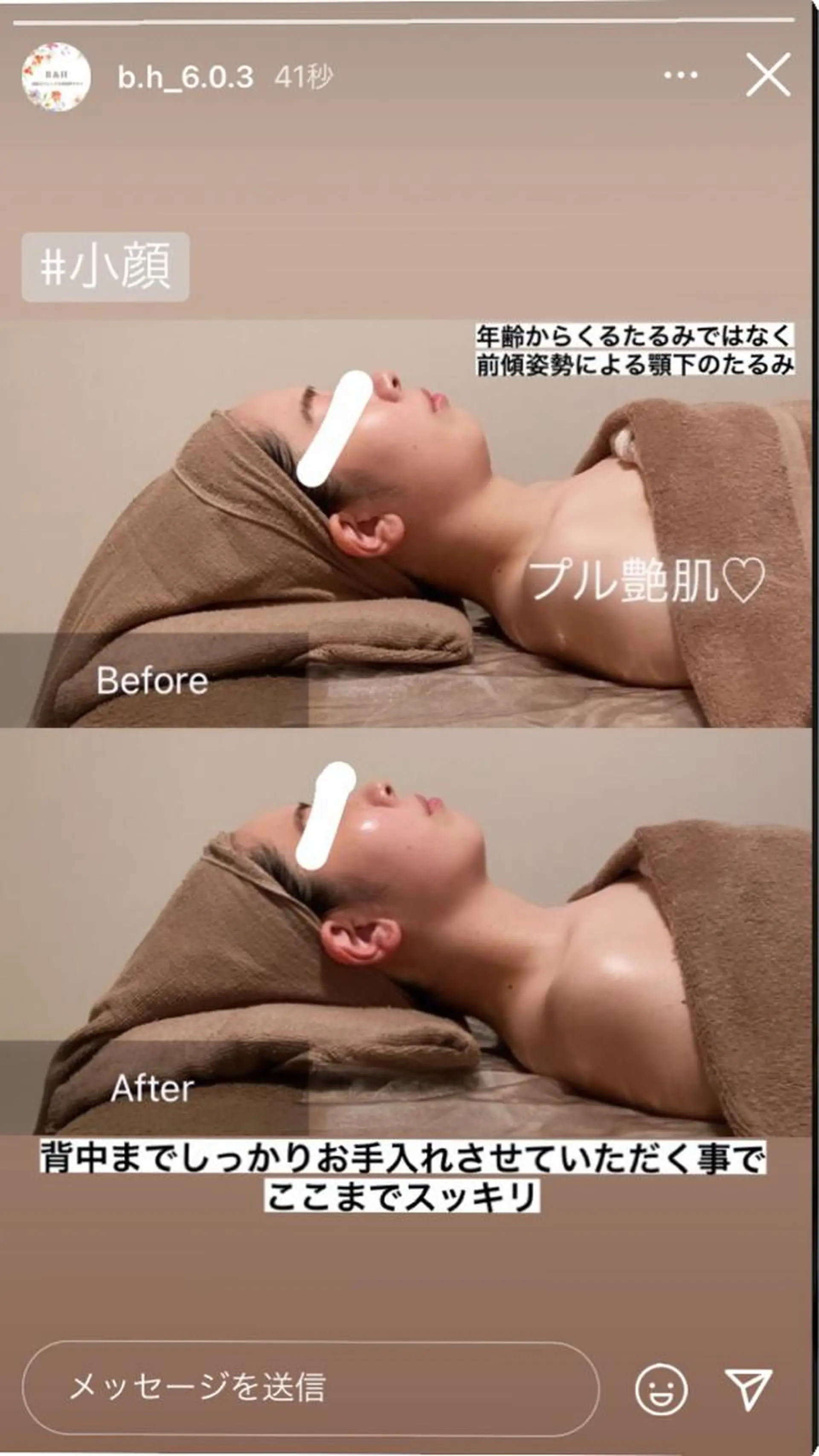 エステ リラク Ｂ&H所属・頭痛•肩こり専門/ 眉サロンB&H心斎橋のエステ・リラクイメージ