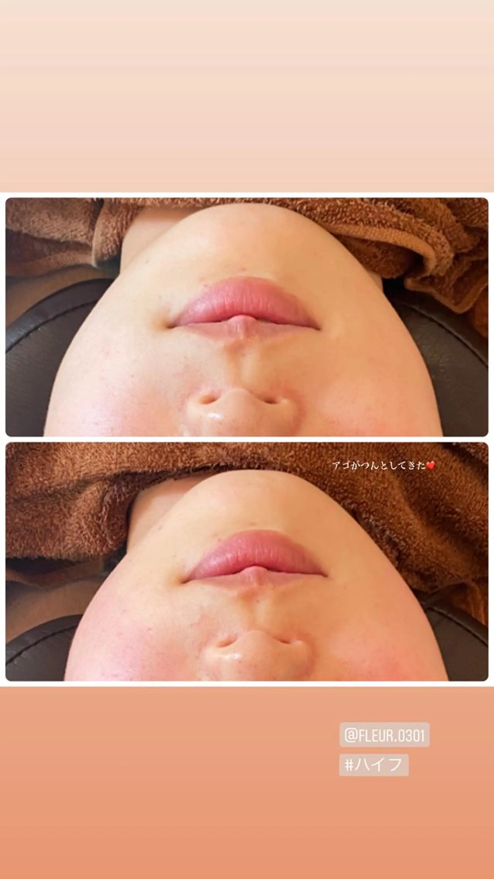 FLEUR大阪・整体 ・ハイフ・痩身・小顔のエステ・リラクイメージ