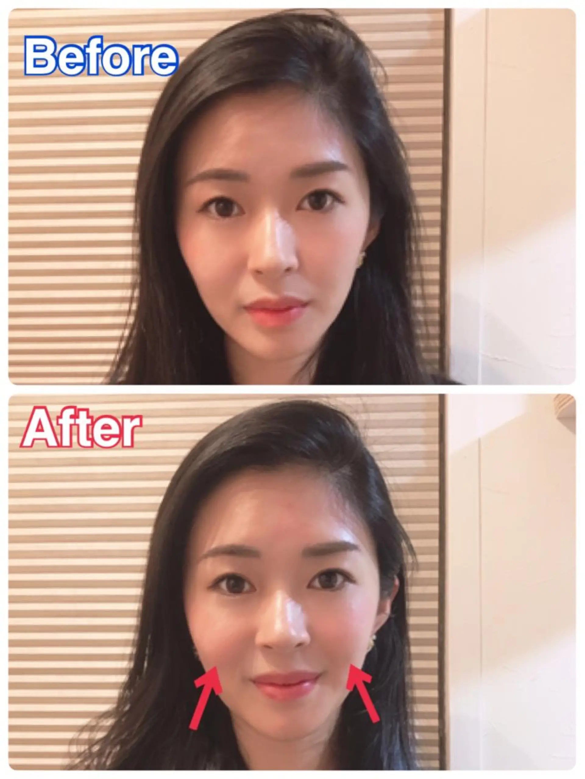 鍼灸整骨院Refine所属・鍼灸 Refineのその他イメージ