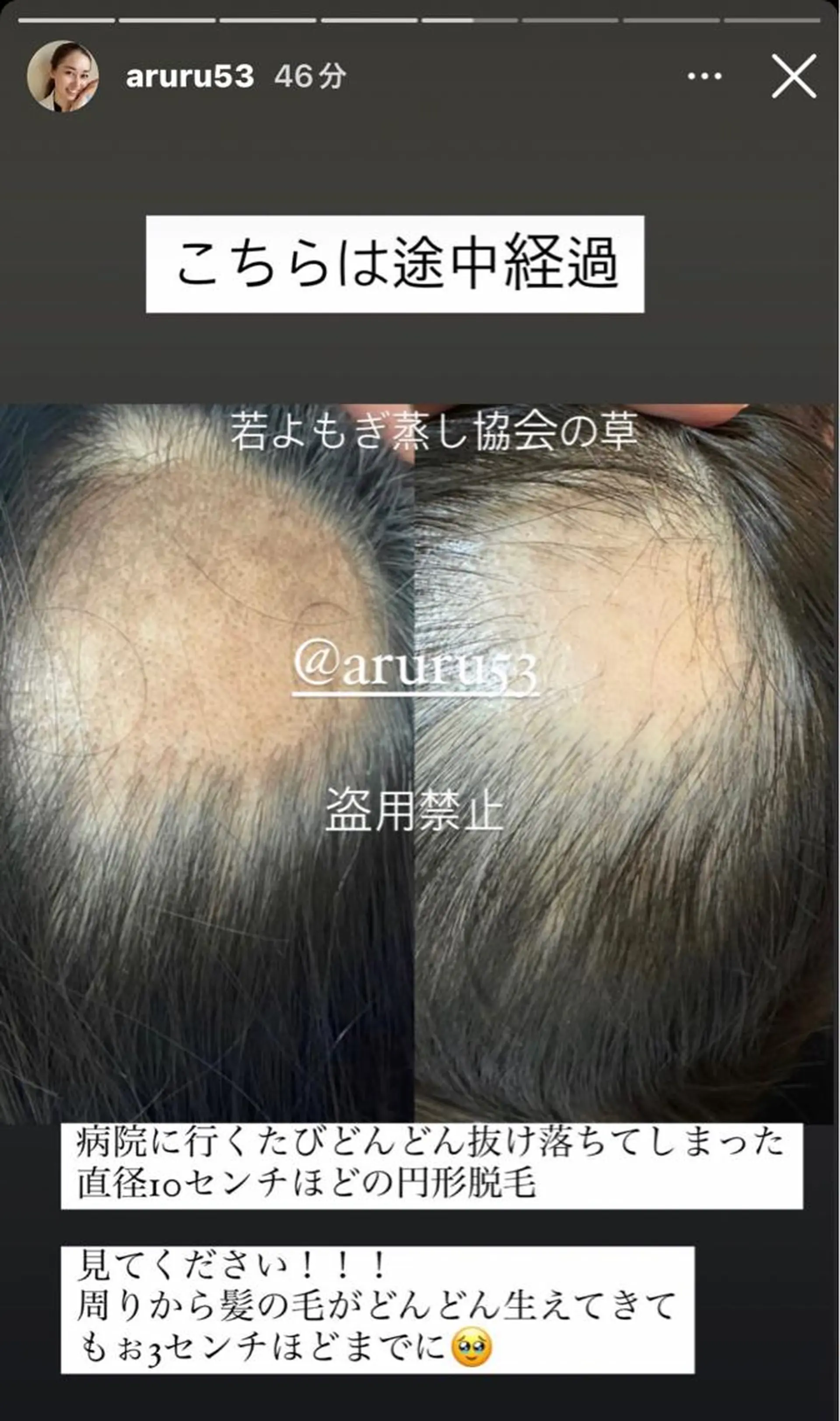 private salon Dea_maris シュガーリング&パーソナルボディケア所属・シミ改善・韓国肌管理 ボディメイク痩身のその他イメージ