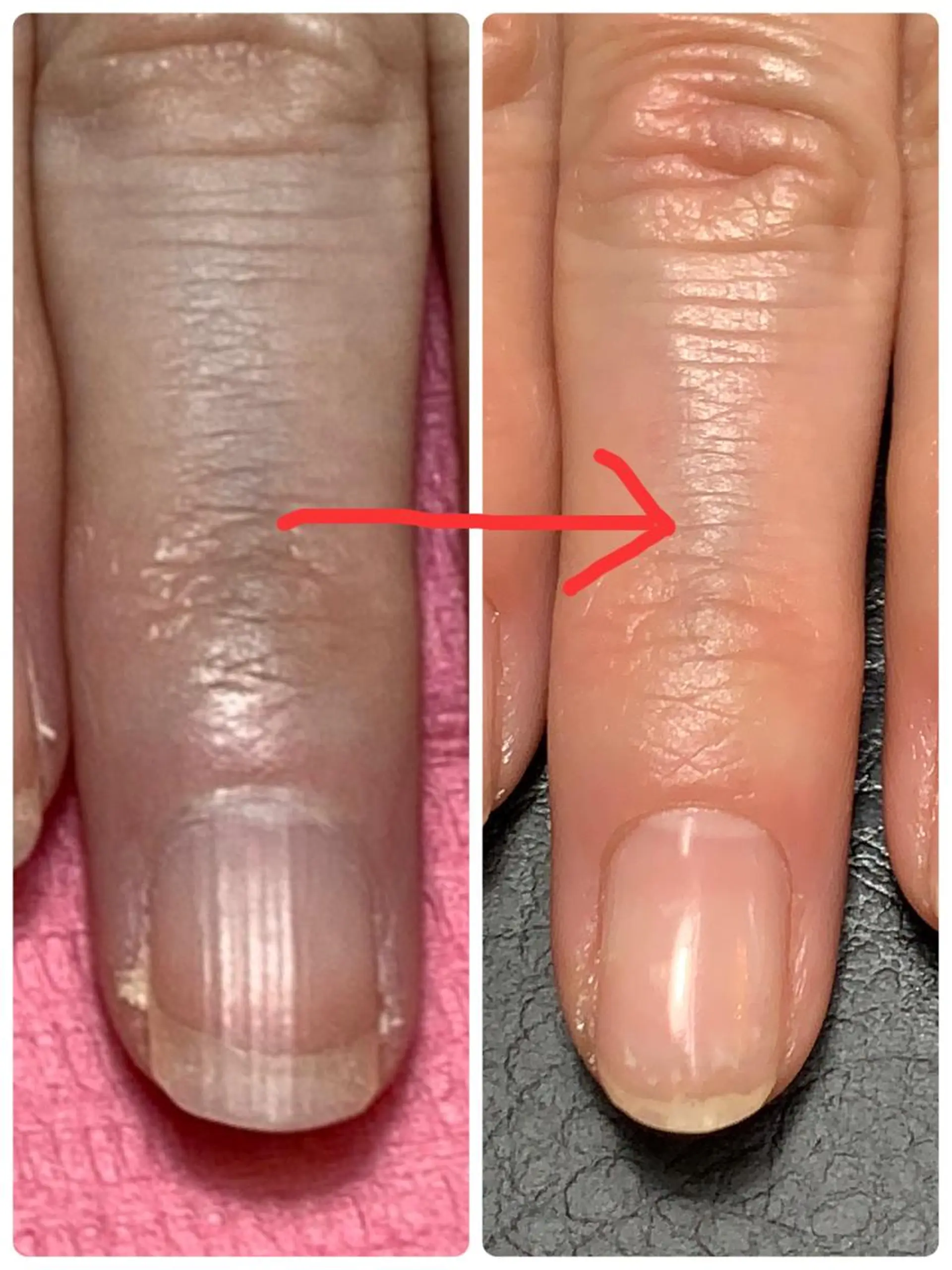 ネイル ピンク ハンドケア NAIL ENVYのネイルデザイン