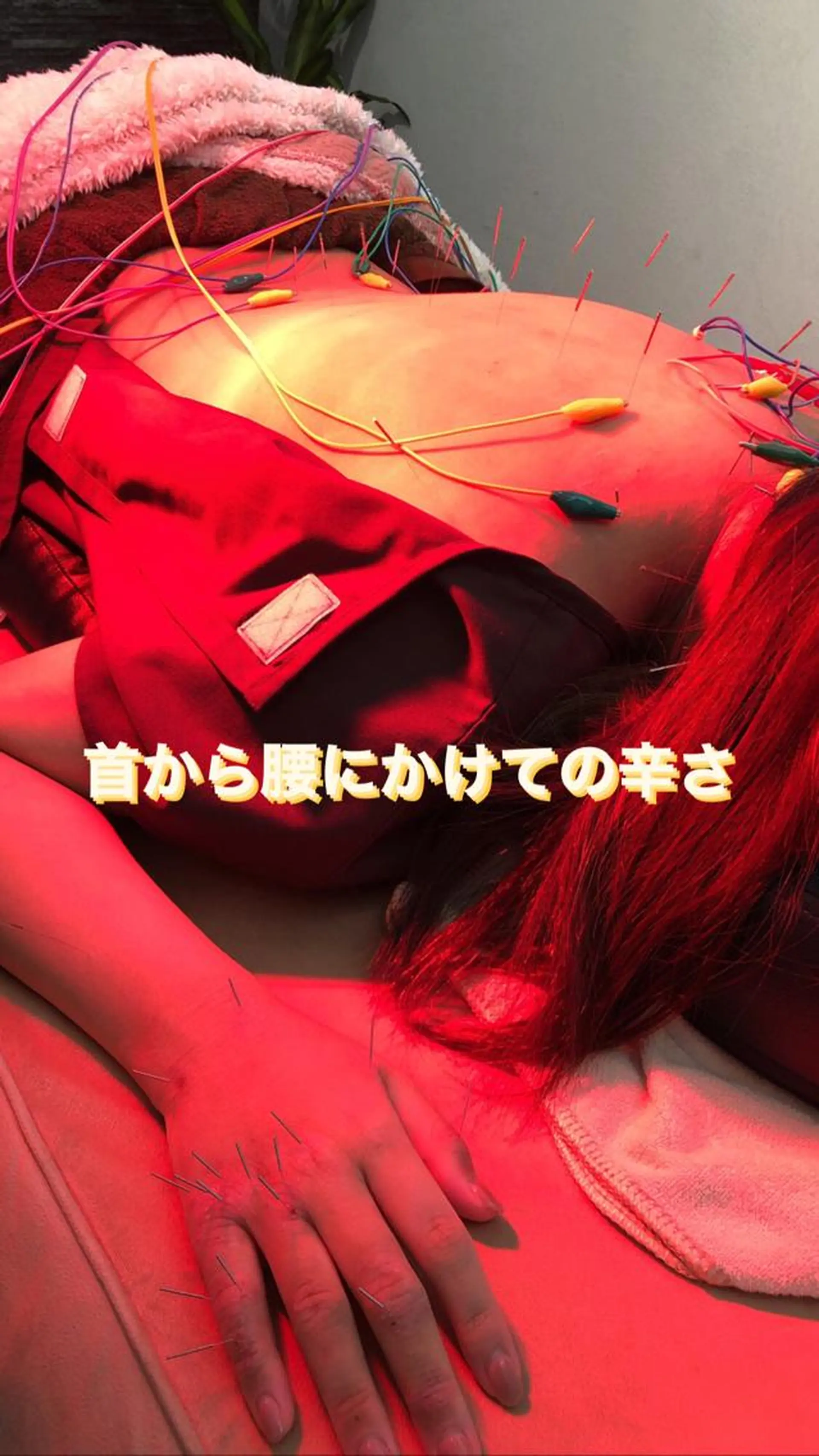 その他 美容鍼灸整体サロンBeauJu所属・小顔矯/美容鍼/鍼灸 BeauJuのその他イメージ