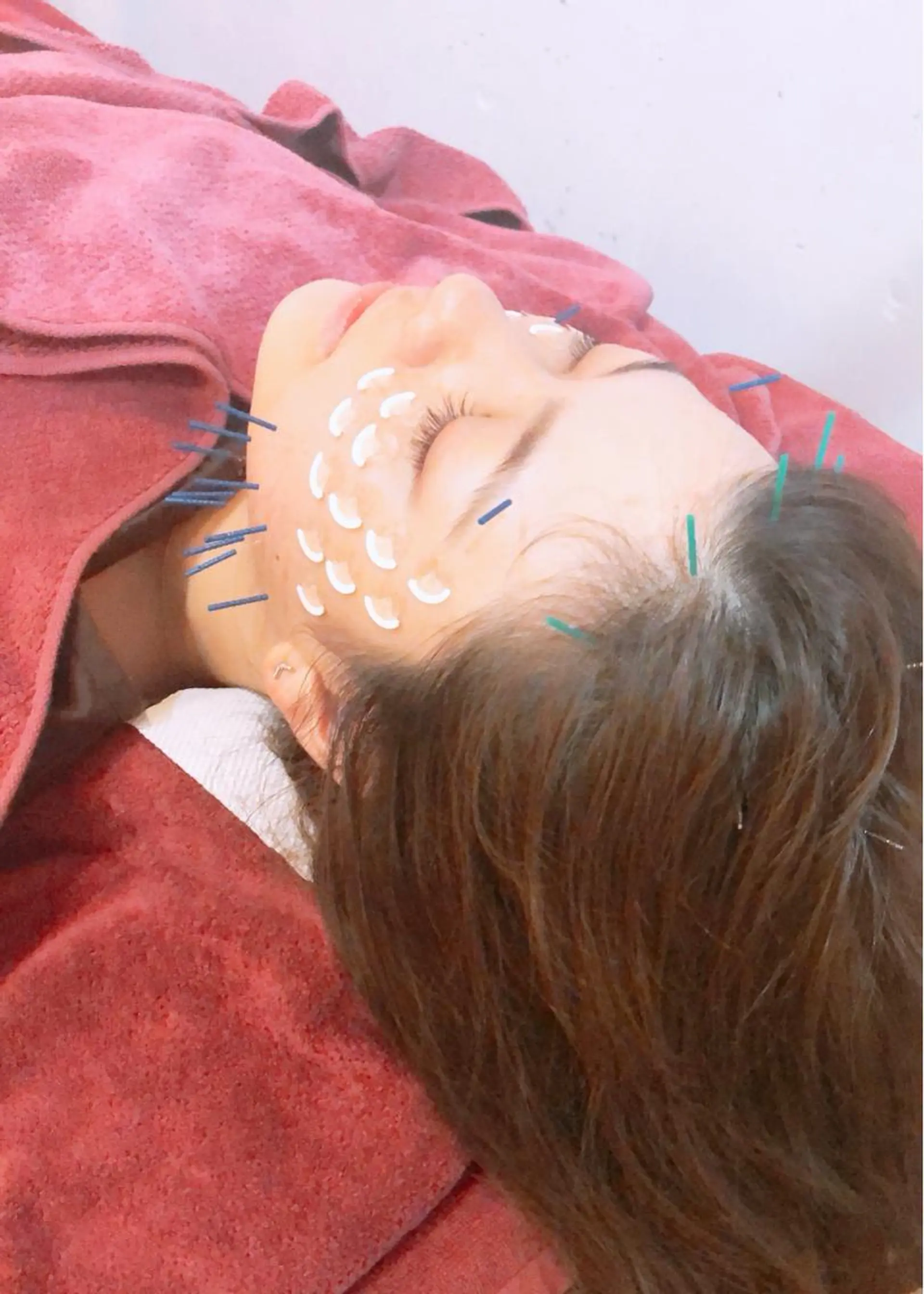 美容鍼灸女性専用 りんご鍼灸治療院のその他イメージ