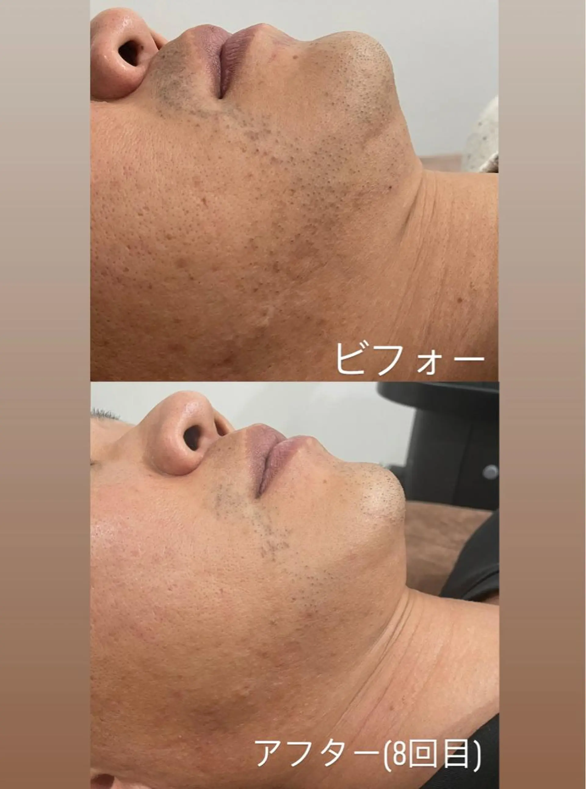 セルフエステエンリケ明石大久保店所属・YUUKI リンパ＆脱毛&毛穴のエステ・リラクイメージ