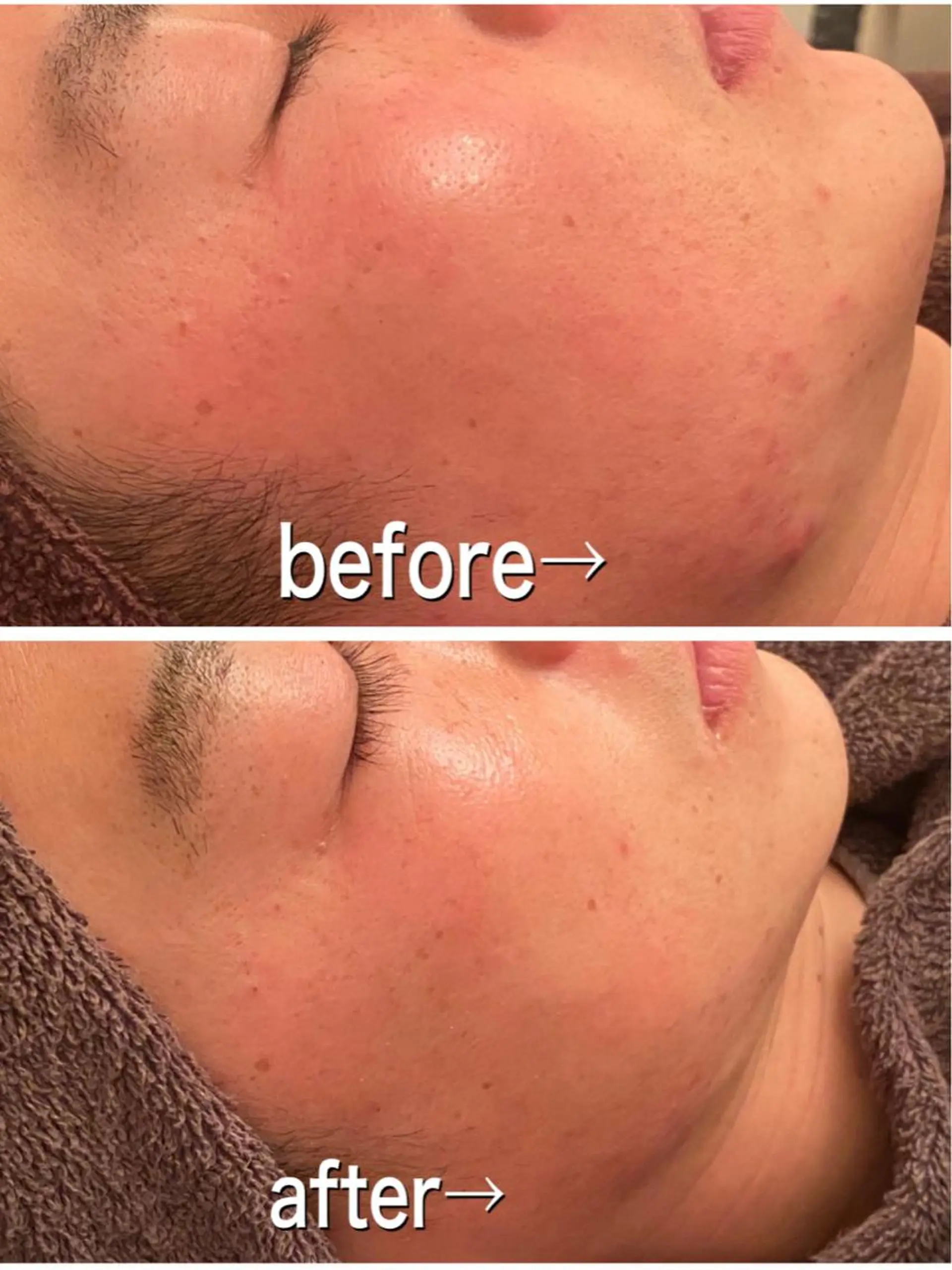 食べながら魅せボディ éclatJua川越のエステ・リラクイメージ