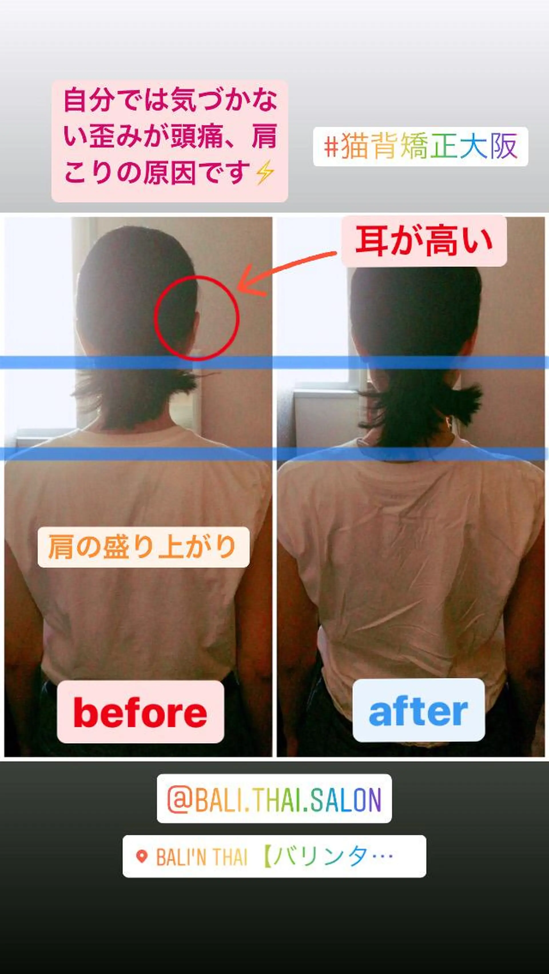 🌈歪み改善🌈 バリンタイ すぎうらのエステ・リラクイメージ