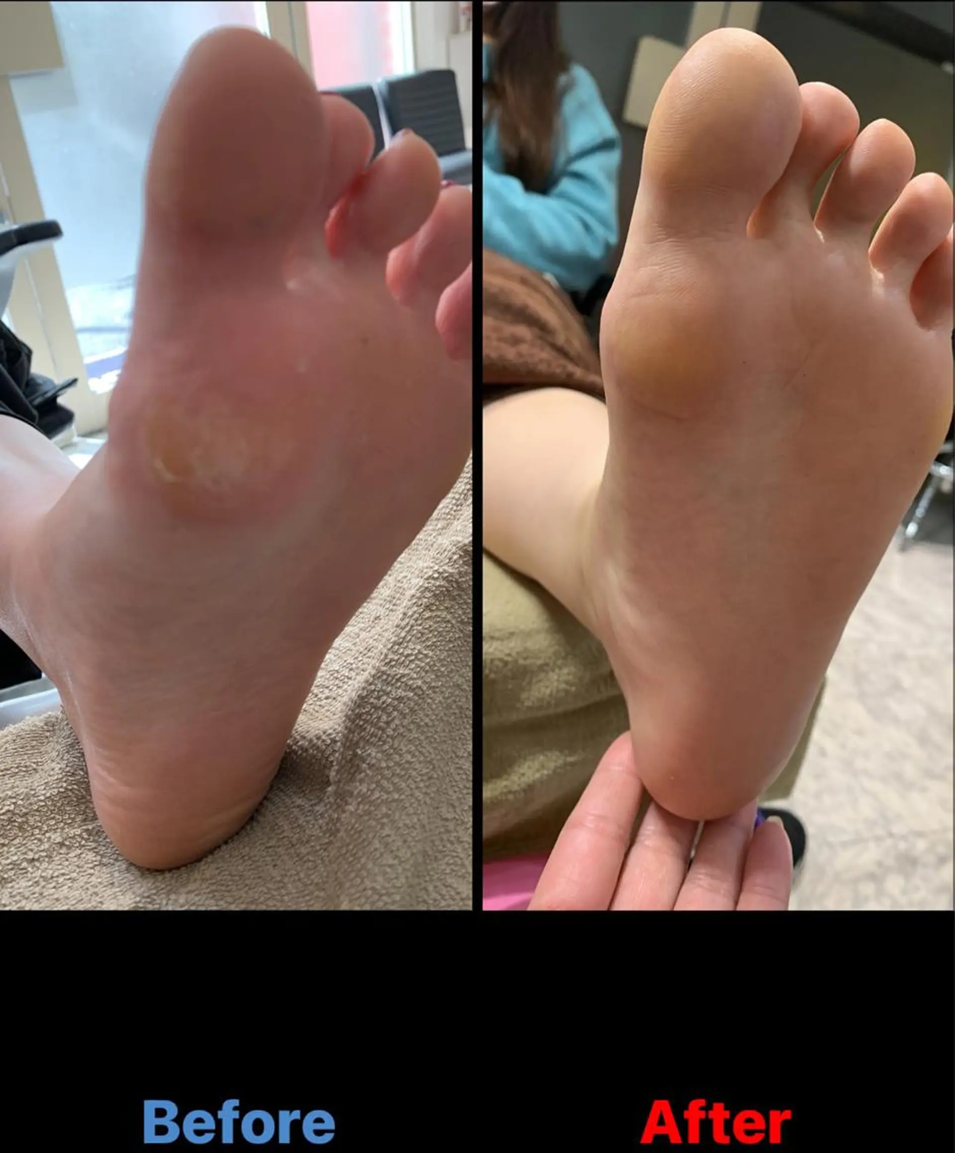 ネイル 毛穴改善/脱毛 ネイル 川上久仁子のエステ・リラクイメージ