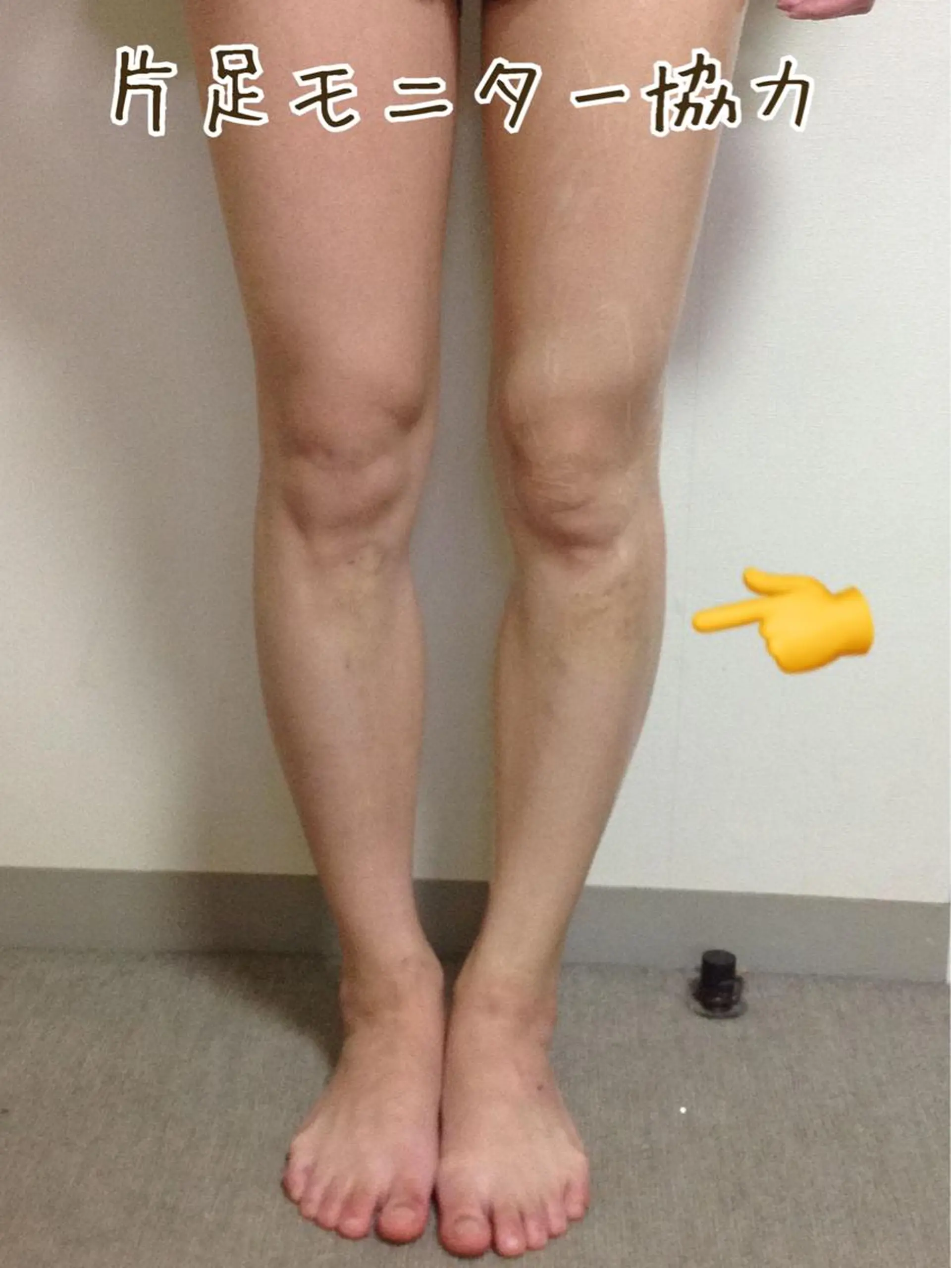 ニキビ・ 肌荒れ専門店のエステ・リラクイメージ