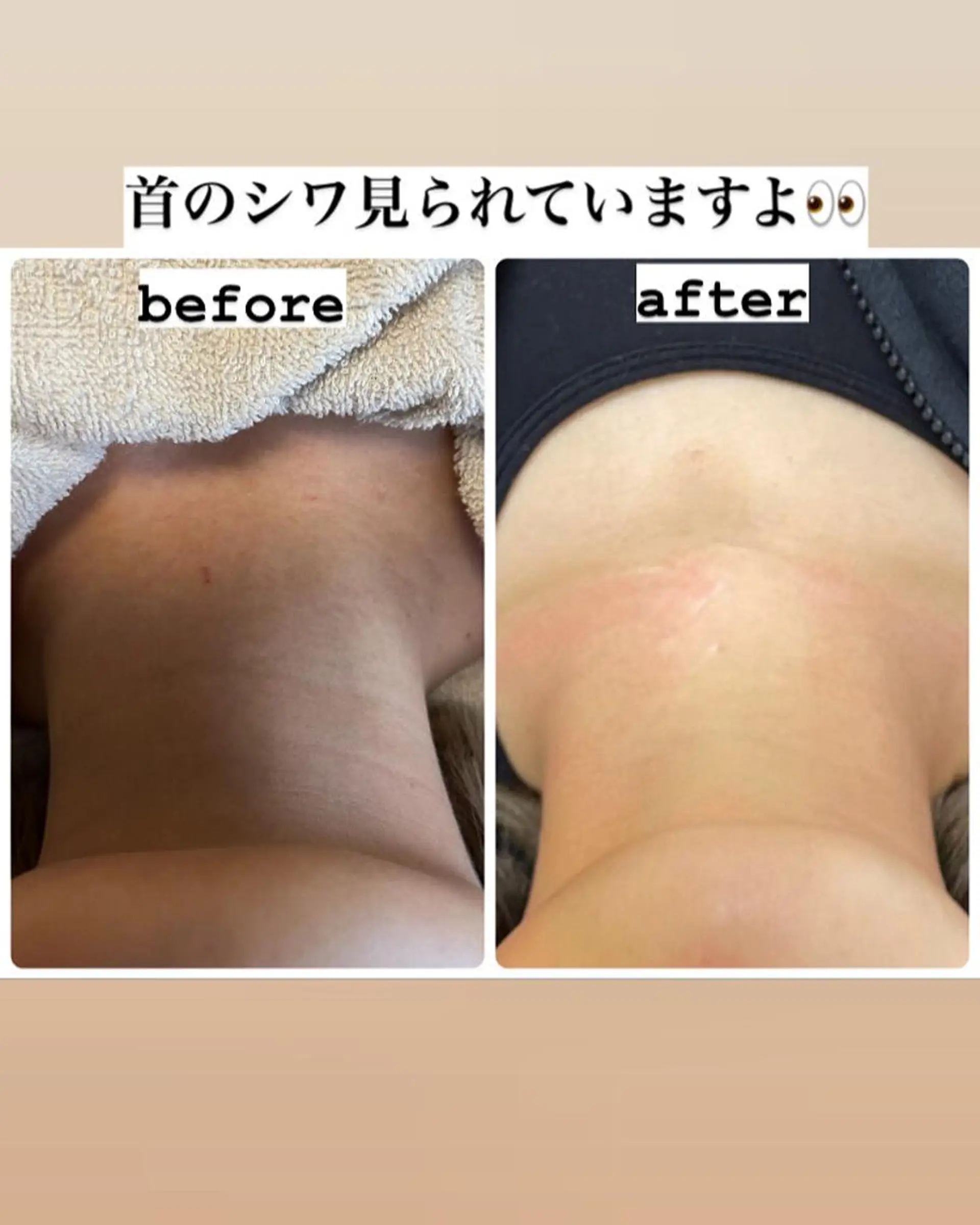 ショート カラー パーマ ヘアアレンジ メンズ ネイル マツエク・マツパ アイブロウ エステ ビューティーサロンRavi所属・ビューティーサロン Raviのエステ・リラクイメージ