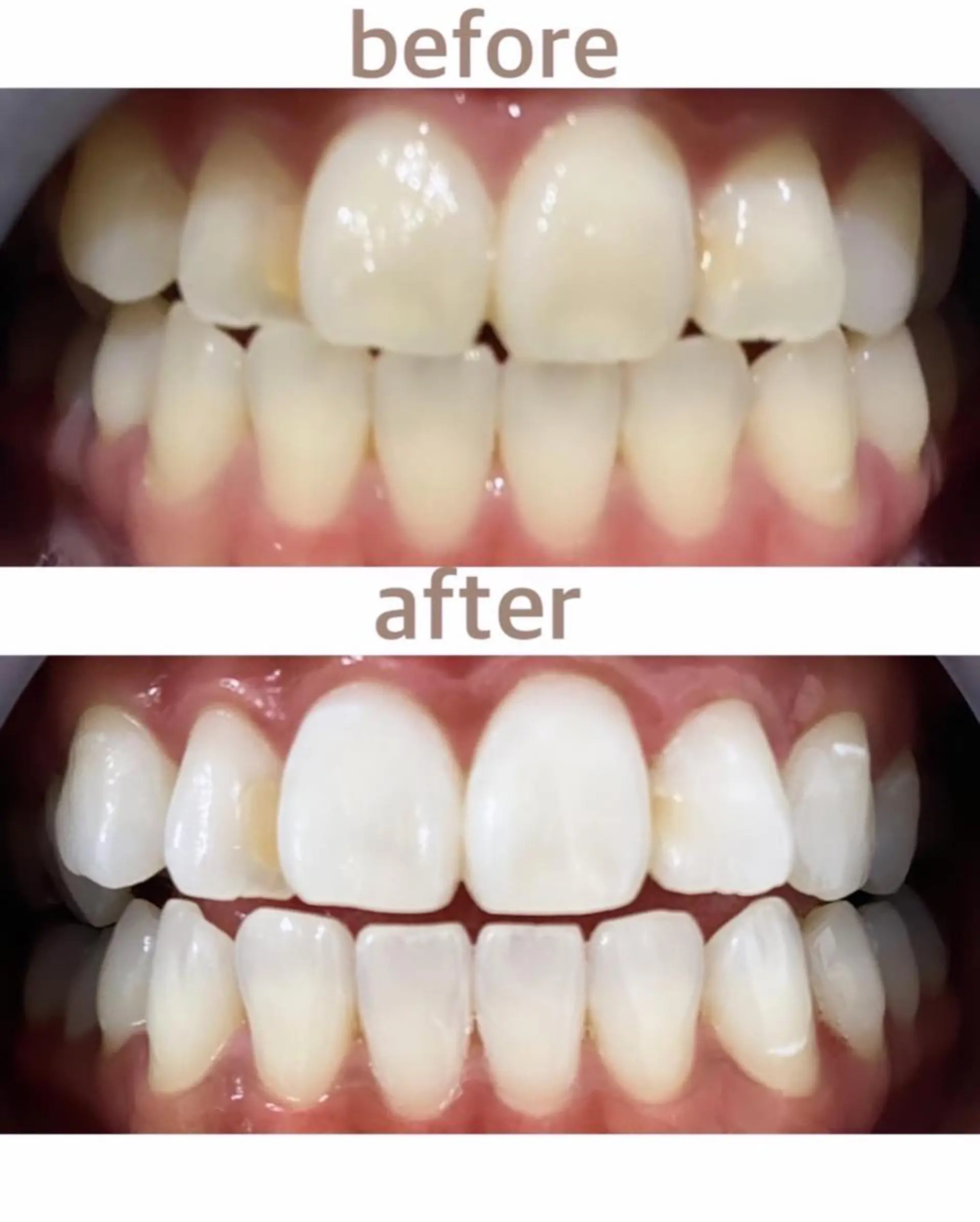 メンズ エステ リラク ホワイトニング ショップ船橋店のエステ・リラクイメージ