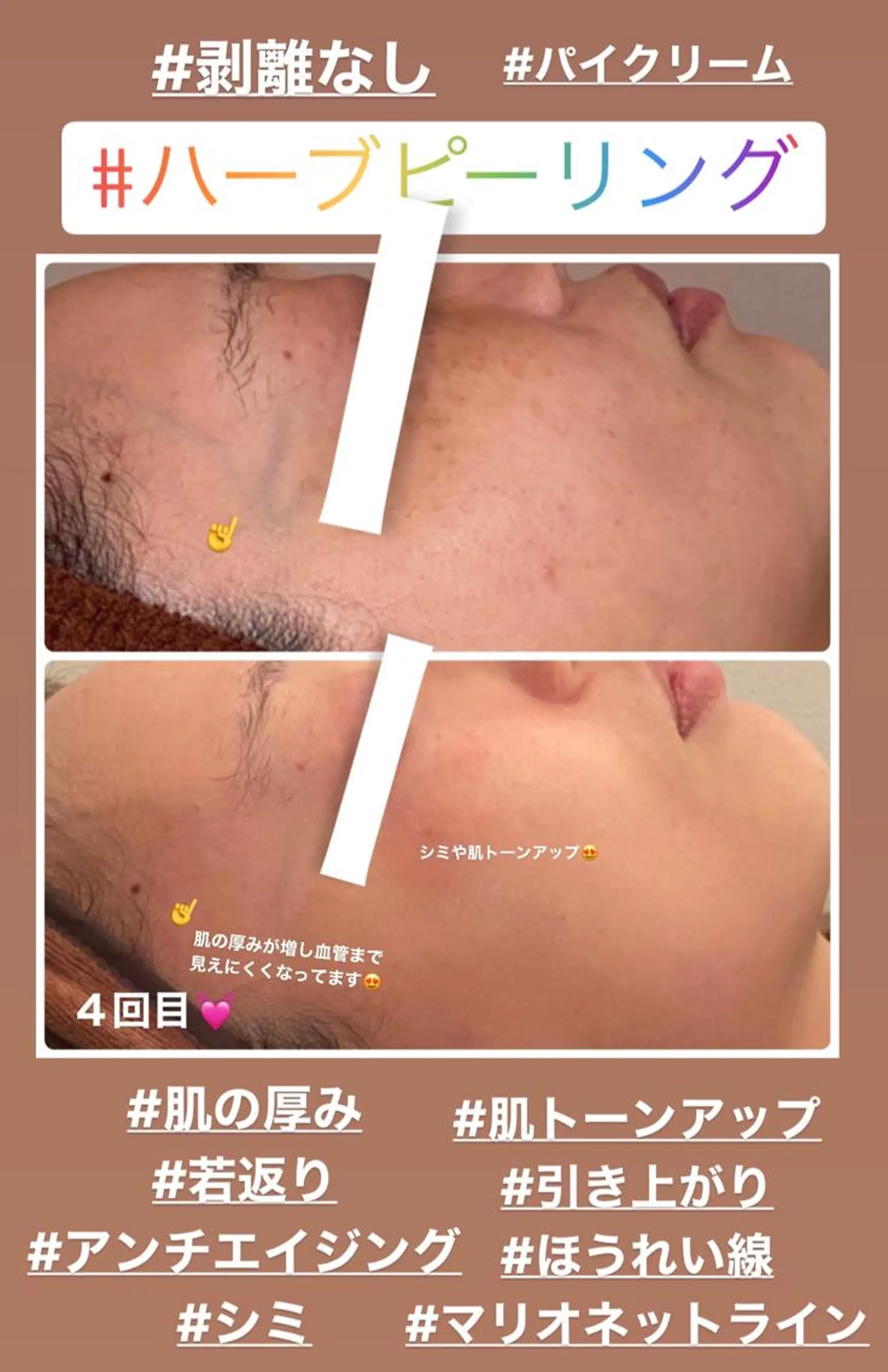 FLEUR大阪・整体 ・ハイフ・痩身・小顔のエステ・リラクイメージ