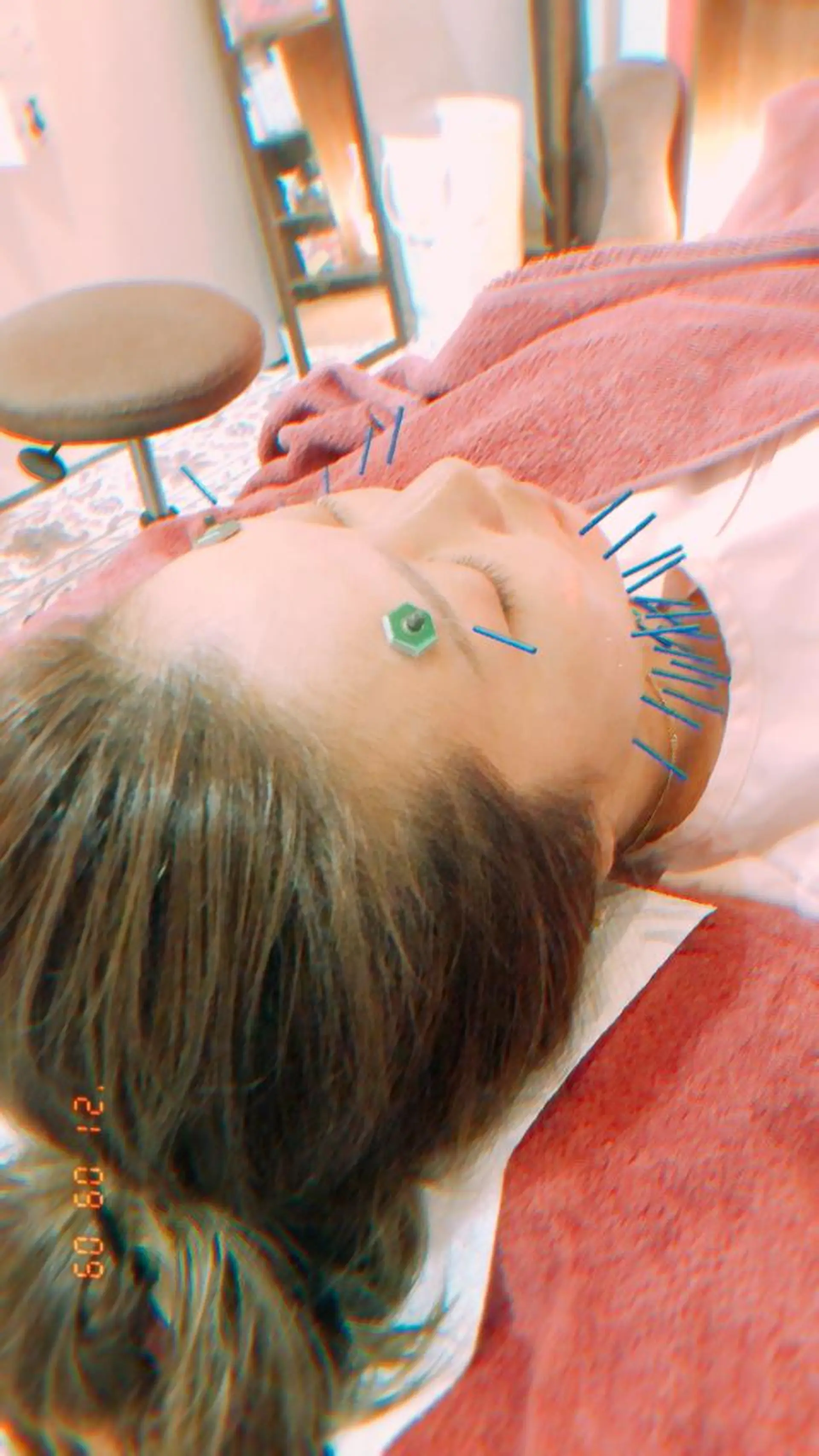 エステ リラク 美容鍼灸女性専用 りんご鍼灸治療院のその他イメージ