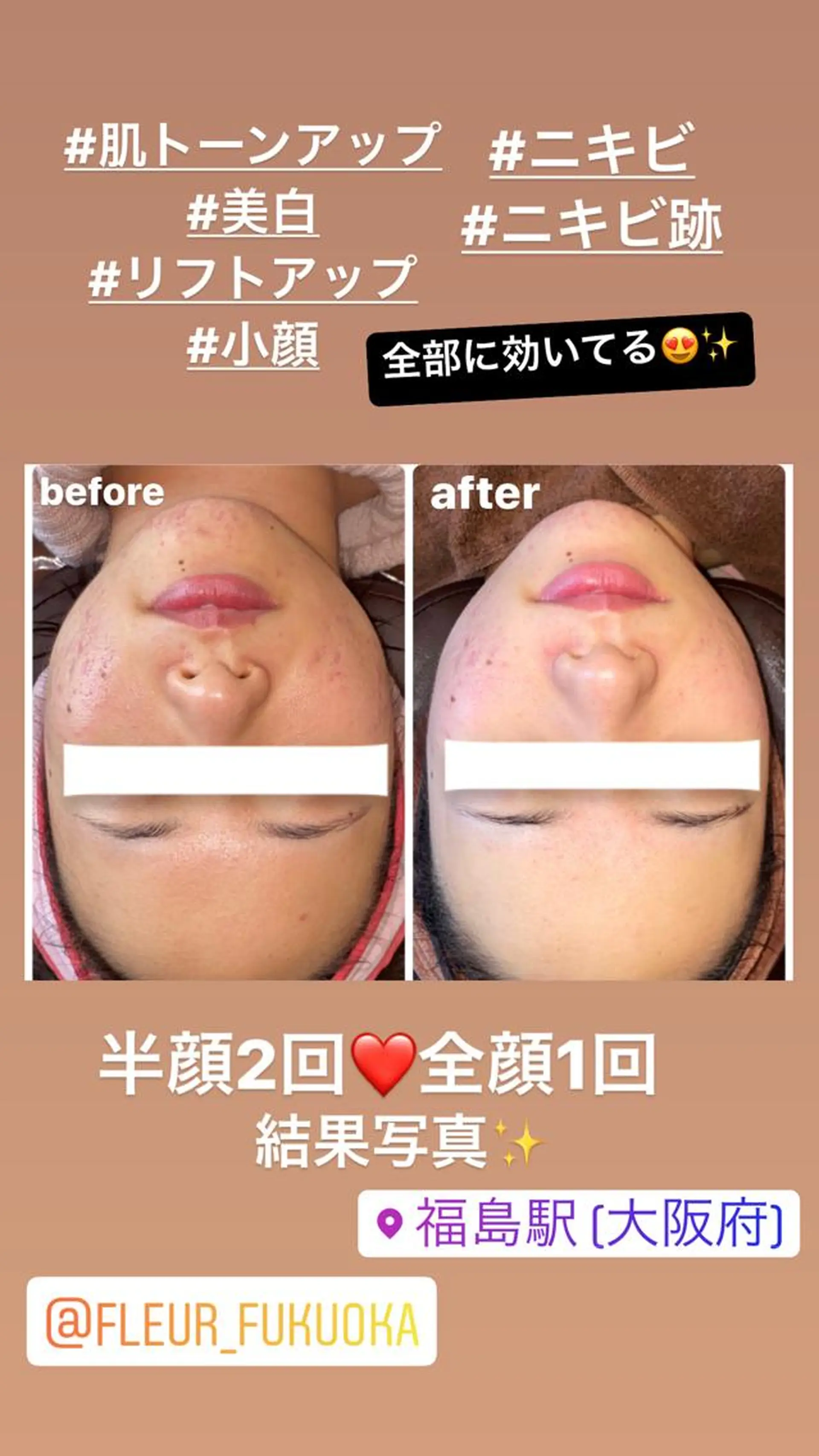 FLEUR大阪・整体 ・ハイフ・痩身・小顔のエステ・リラクイメージ