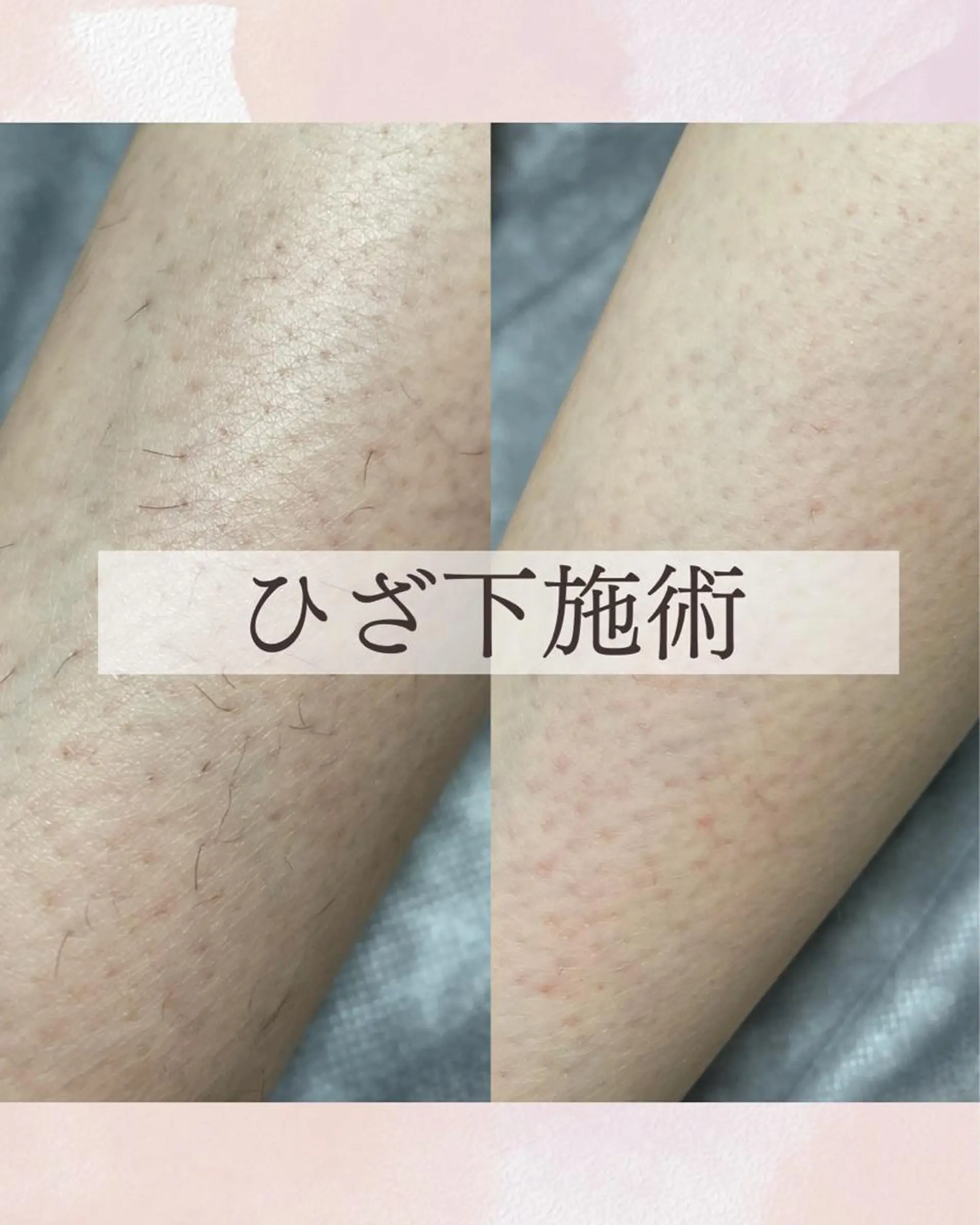 Sugaring Hani Laniのエステ・リラクイメージ