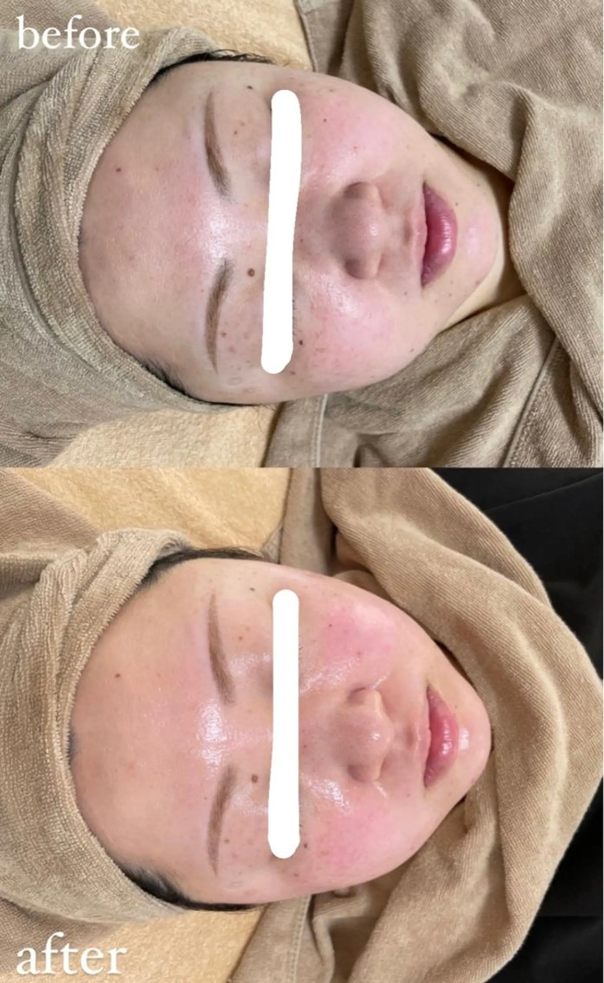 脱毛 エステサロン Mi-mi.iのエステ・リラクイメージ