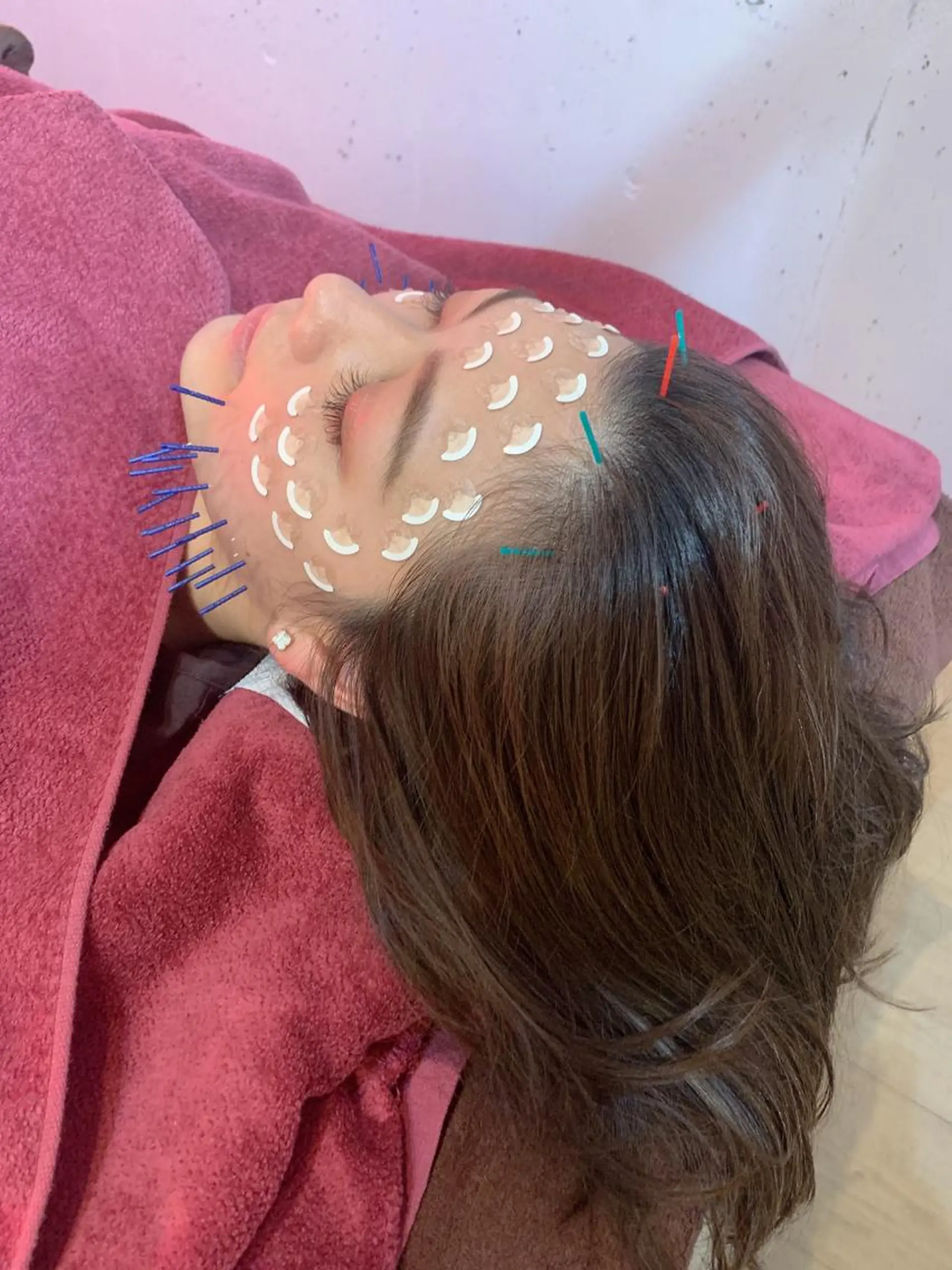 エステ リラク 美容鍼灸女性専用 りんご鍼灸治療院のその他イメージ