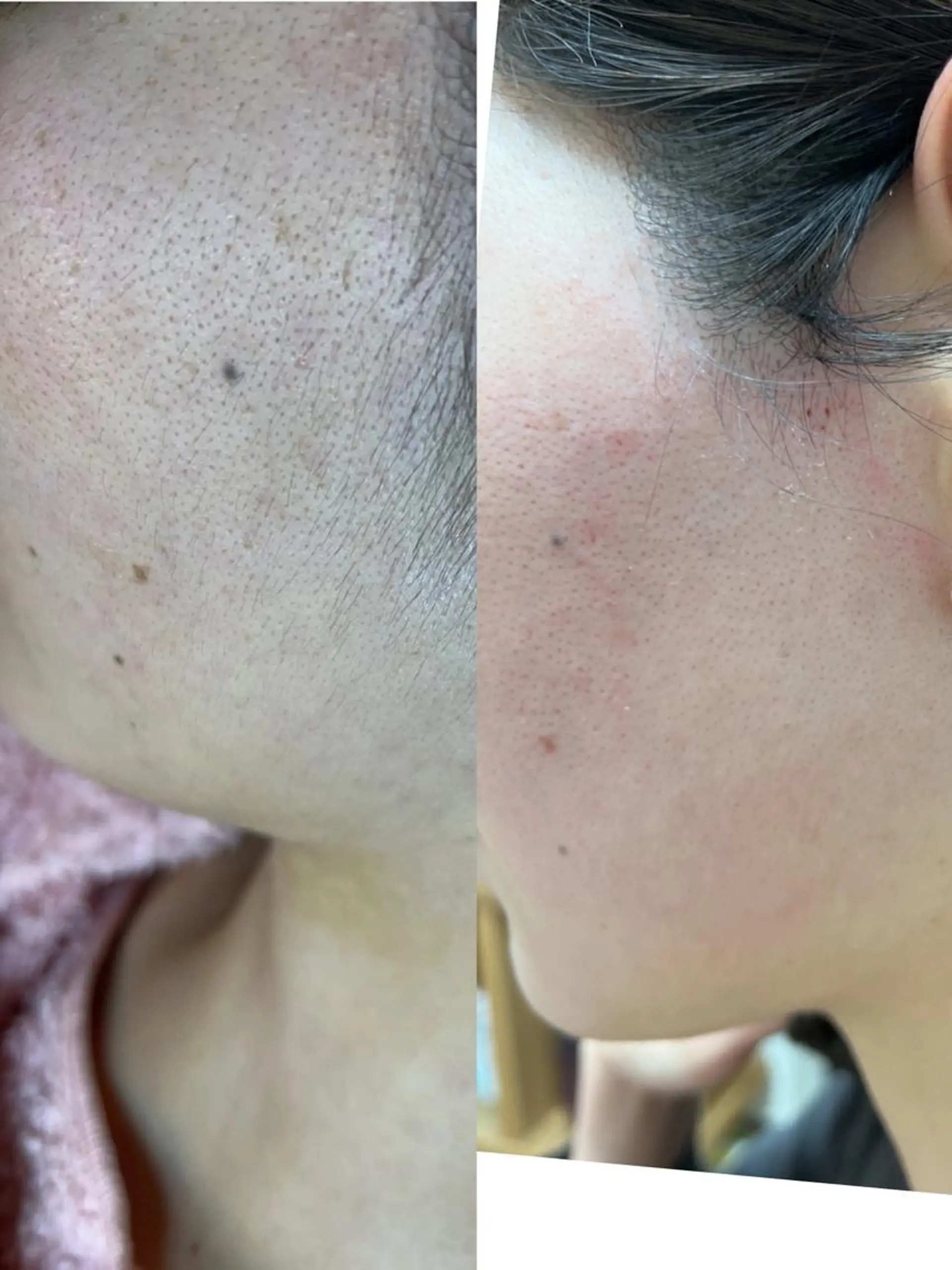 うえつま ふみえのエステ・リラクイメージ