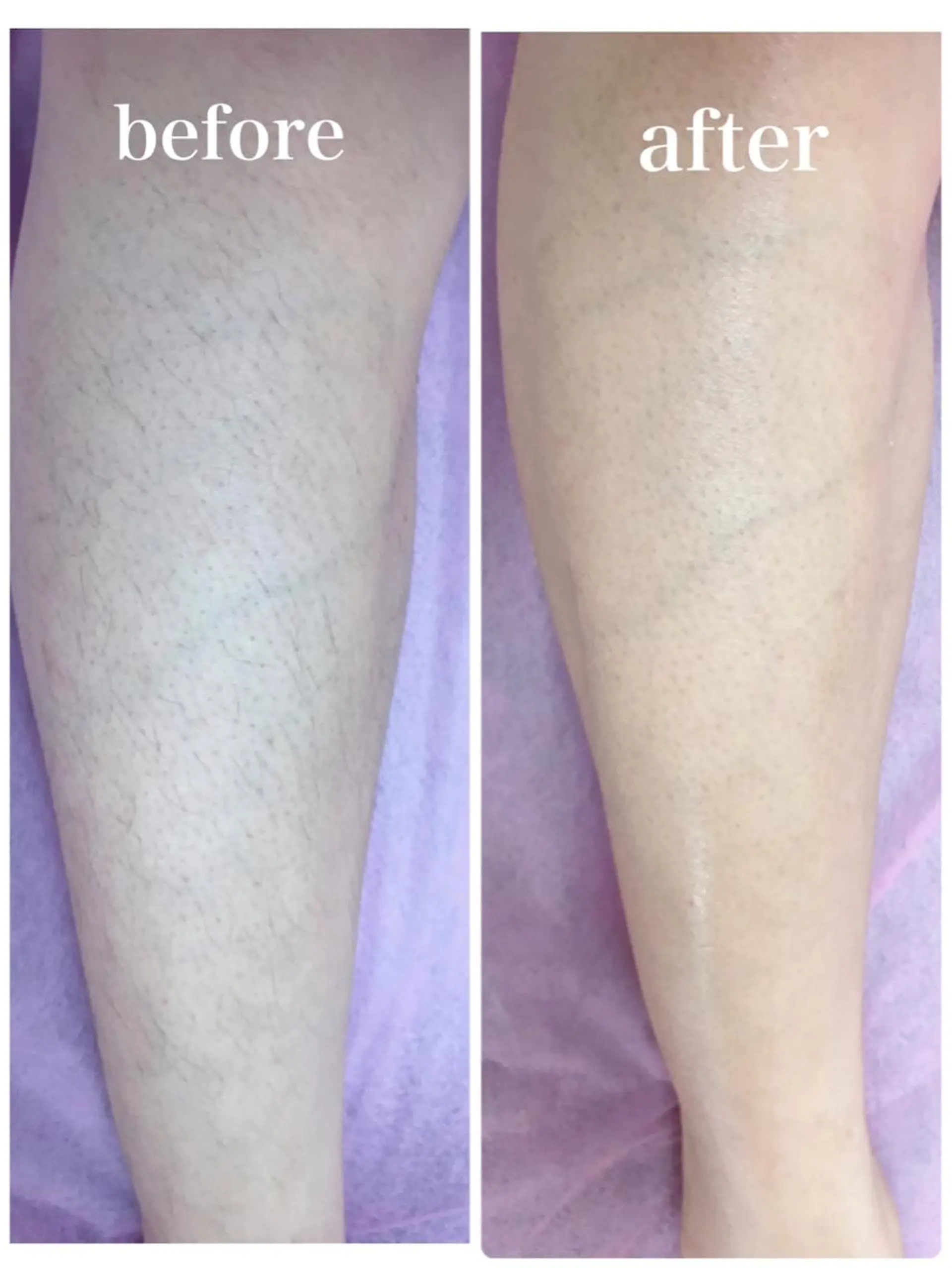 脱毛 MAKANA waxing&relaxation所属・MAKANA 吉岡 小岩店のエステ・リラクイメージ