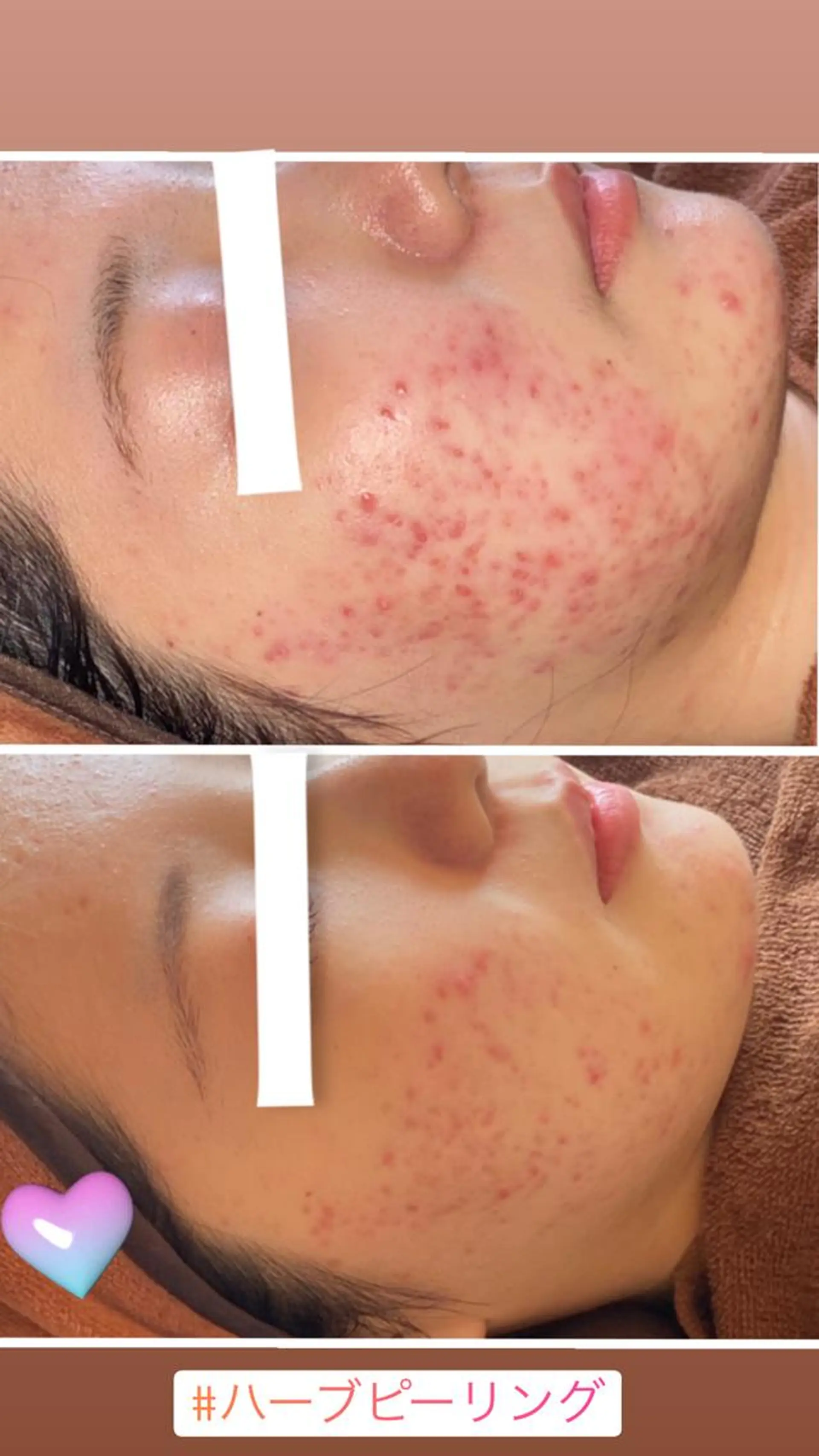 FLEUR大阪・整体 ・ハイフ・痩身・小顔のエステ・リラクイメージ