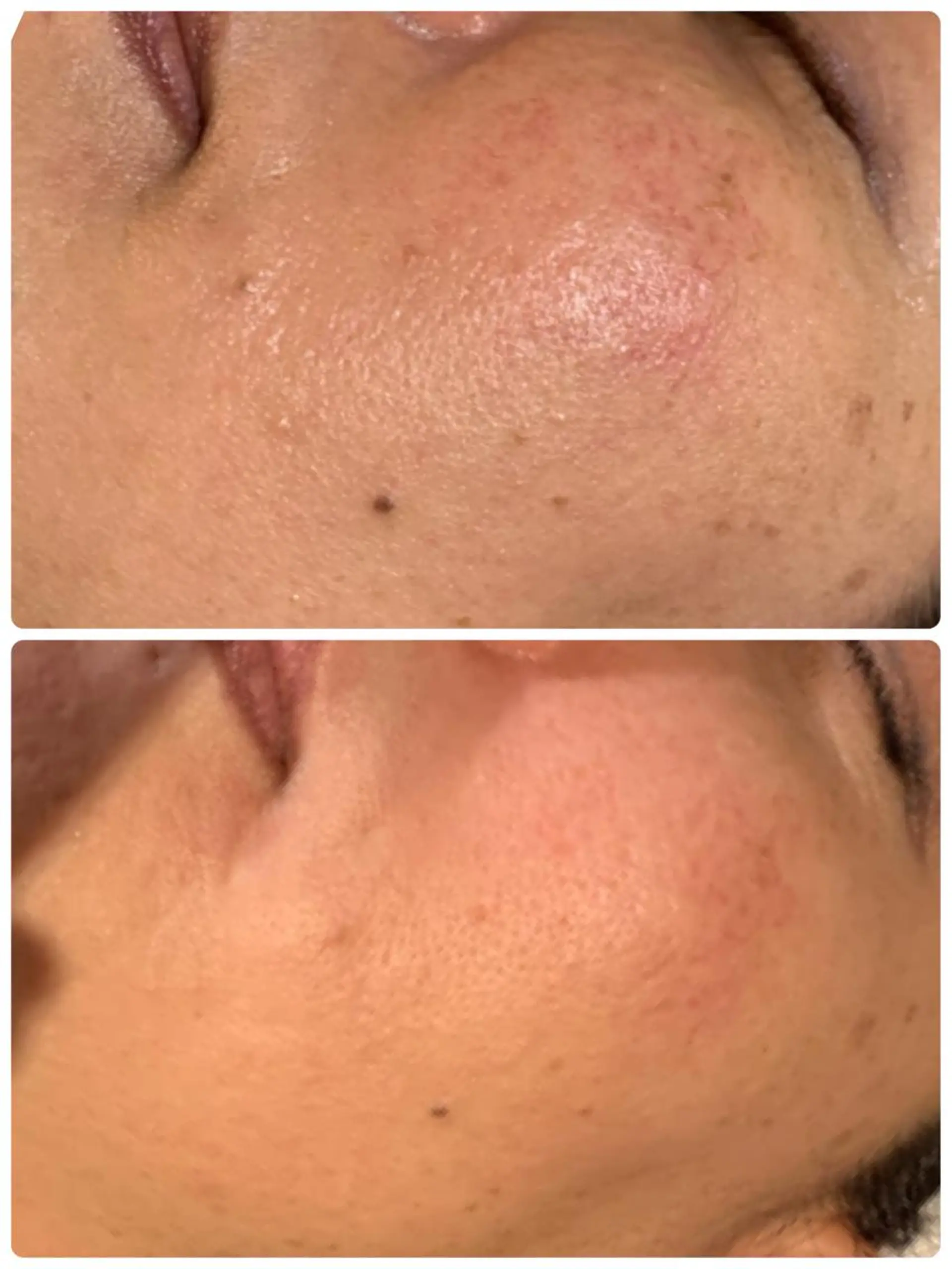 esty hitomiのエステ・リラクイメージ