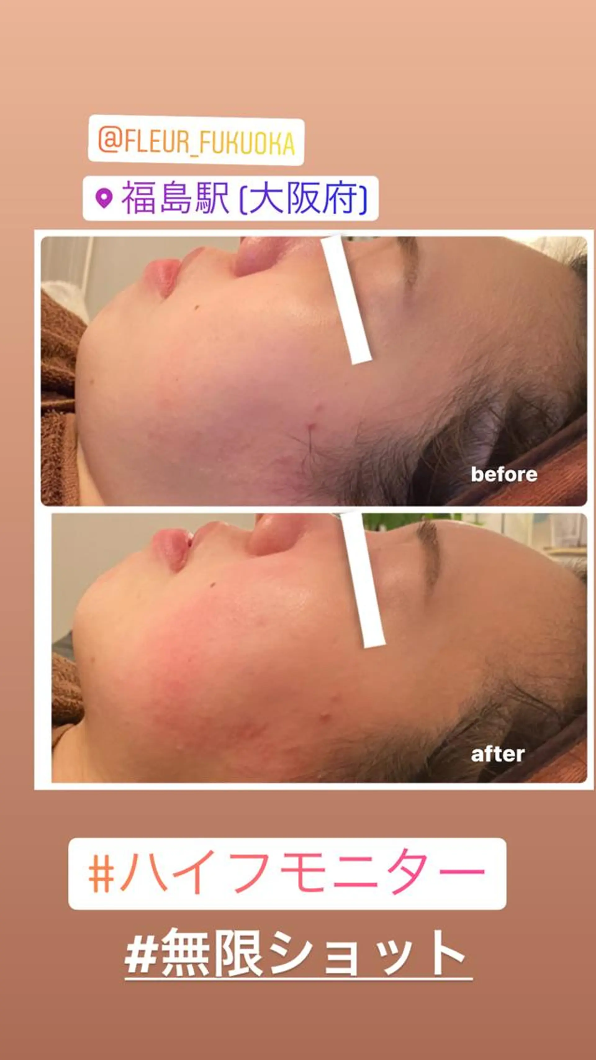 FLEUR大阪・整体 ・ハイフ・痩身・小顔のエステ・リラクイメージ