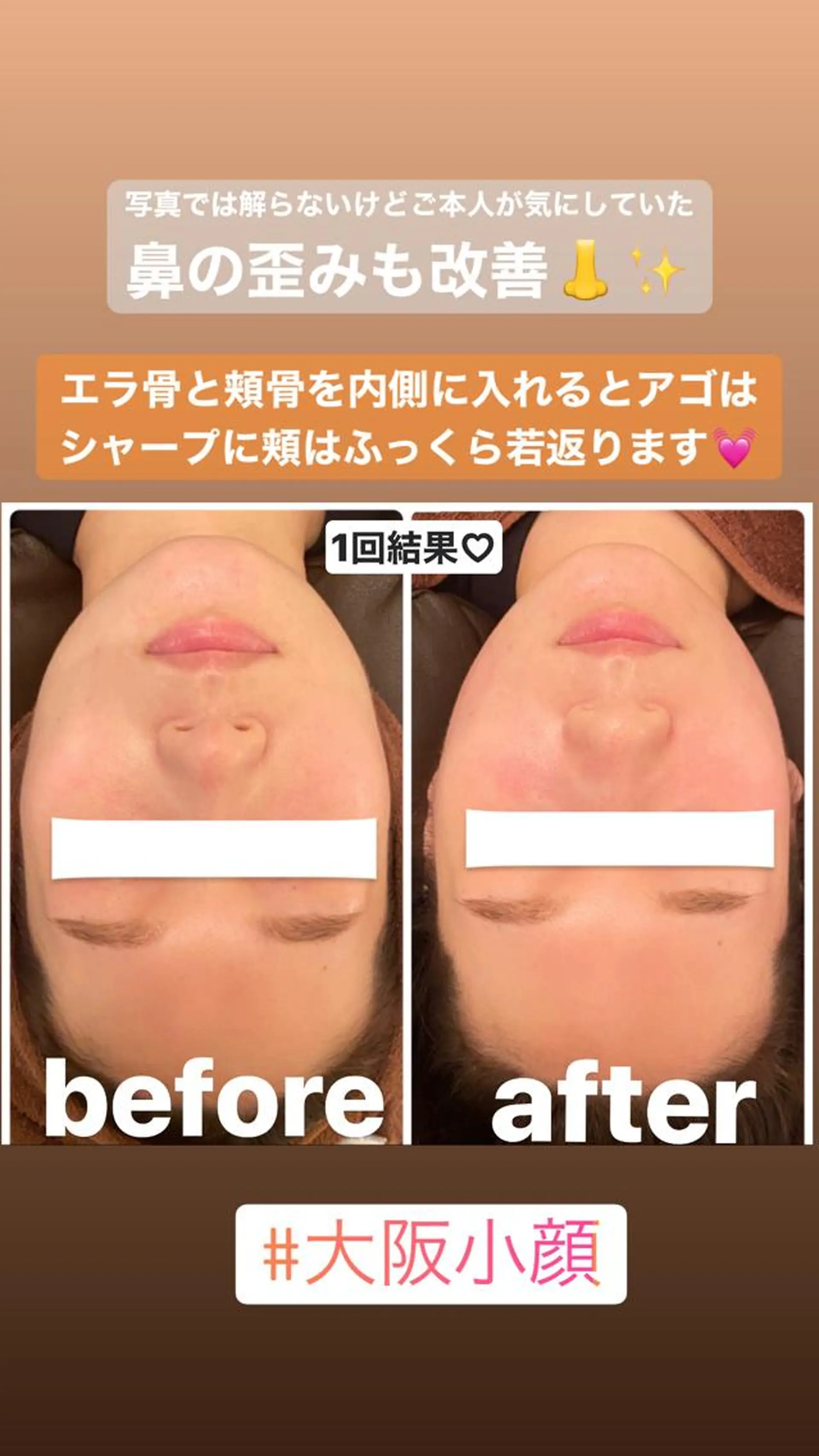 FLEUR大阪・整体 ・ハイフ・痩身・小顔のエステ・リラクイメージ