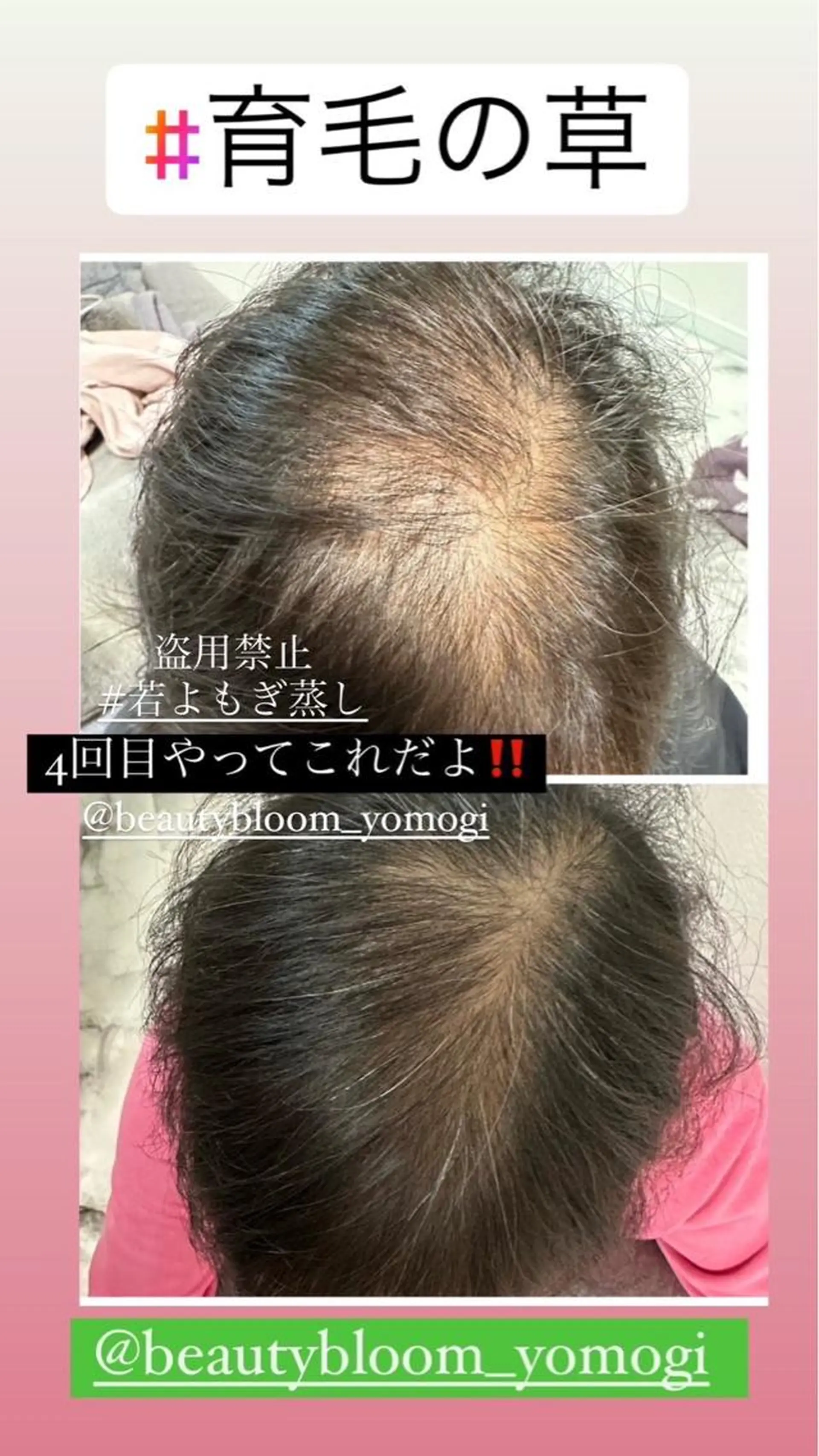 private salon Dea_maris シュガーリング&パーソナルボディケア所属・シミ改善・韓国肌管理 ボディメイク痩身のその他イメージ