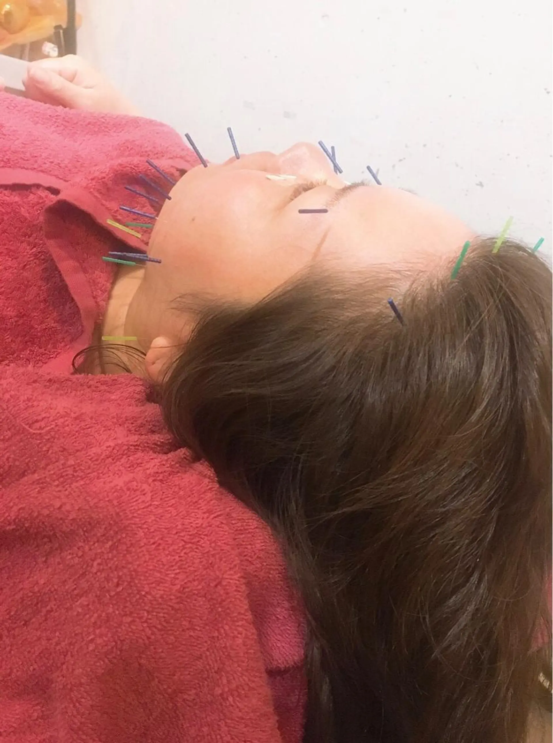 美容鍼灸女性専用 りんご鍼灸治療院のその他イメージ