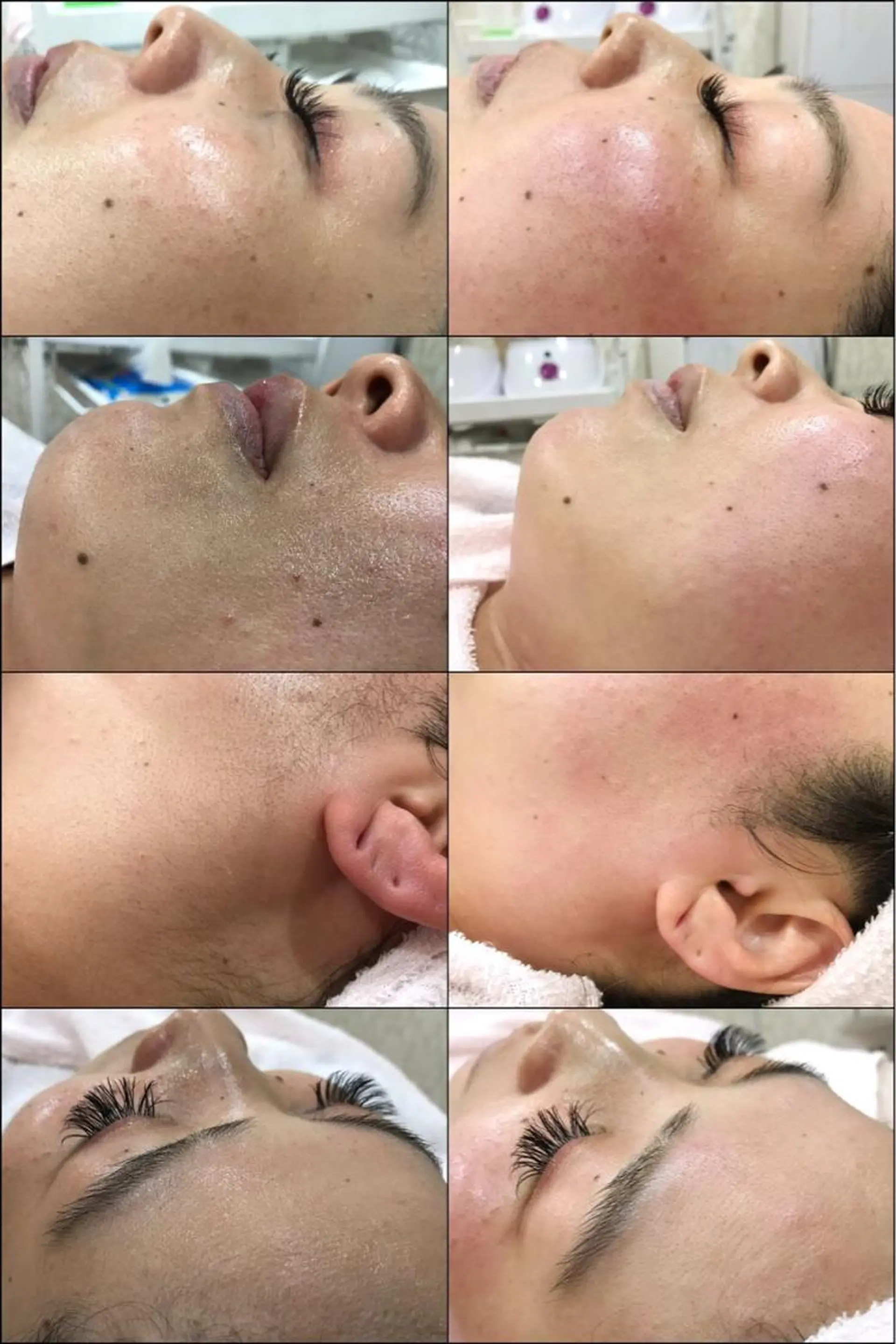 フェイシャル/脱毛 ジョアアンジェ　田中のエステ・リラクイメージ