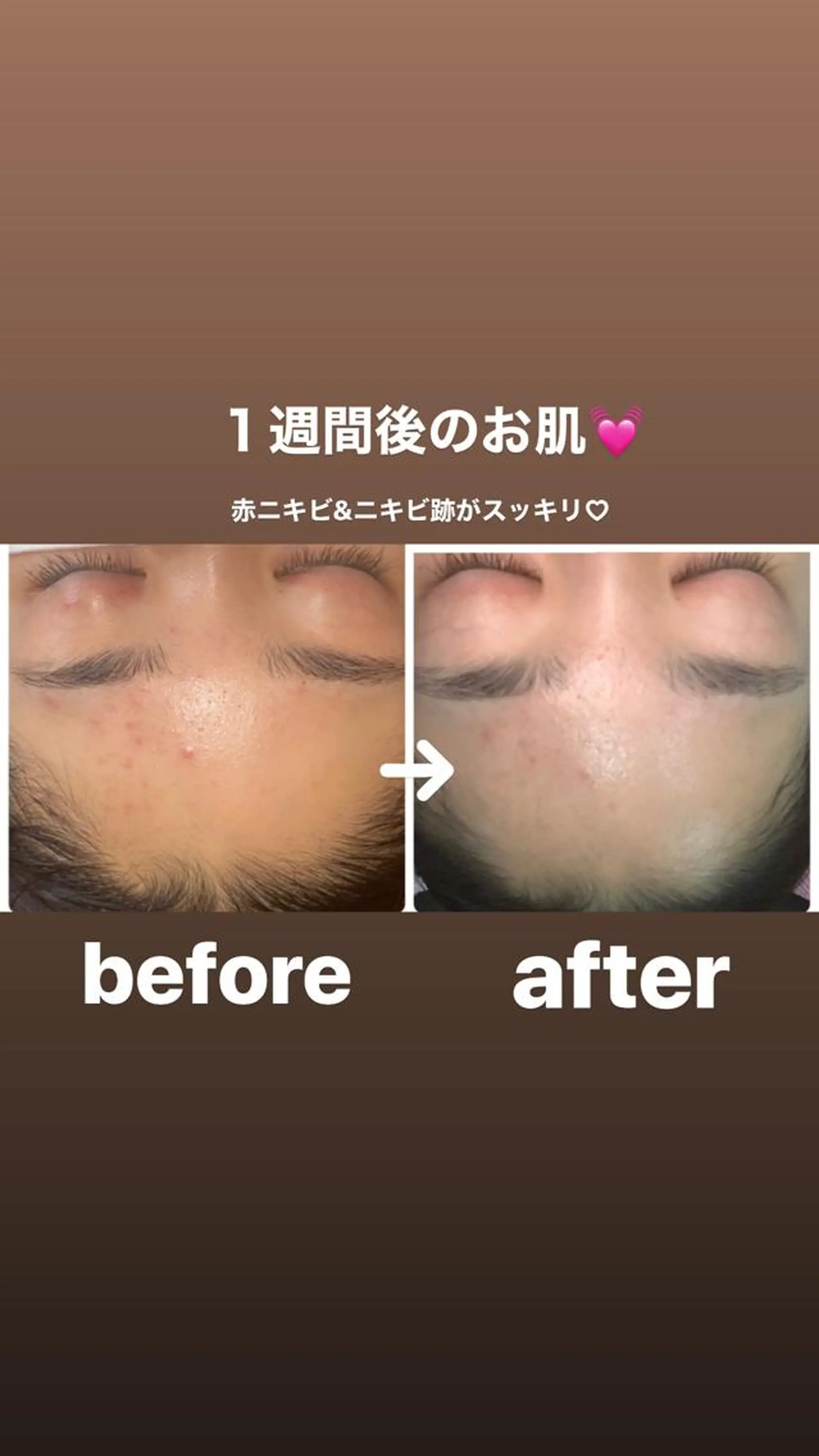 FLEUR大阪・整体 ・ハイフ・痩身・小顔のエステ・リラクイメージ