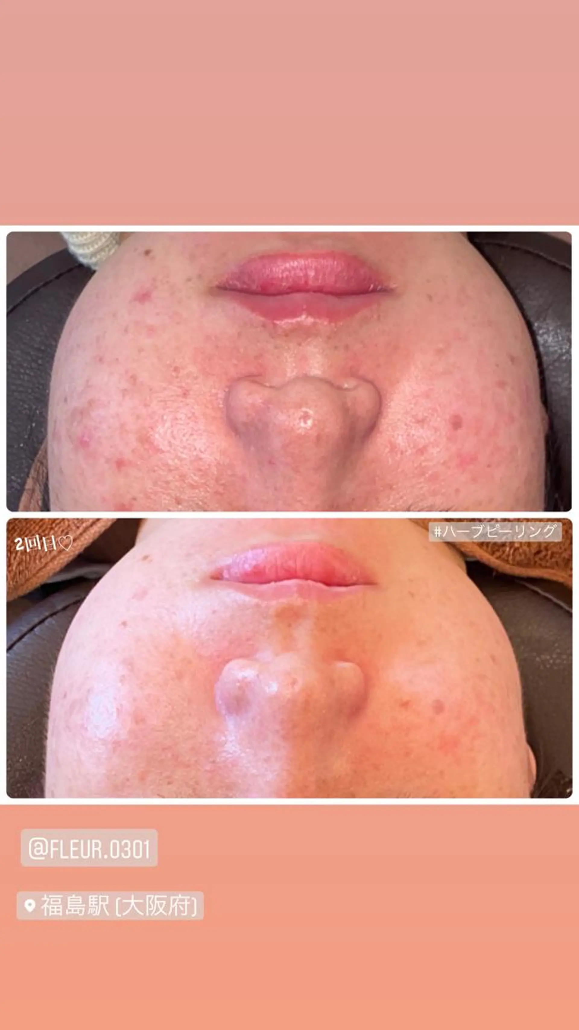 FLEUR大阪・整体 ・ハイフ・痩身・小顔のエステ・リラクイメージ